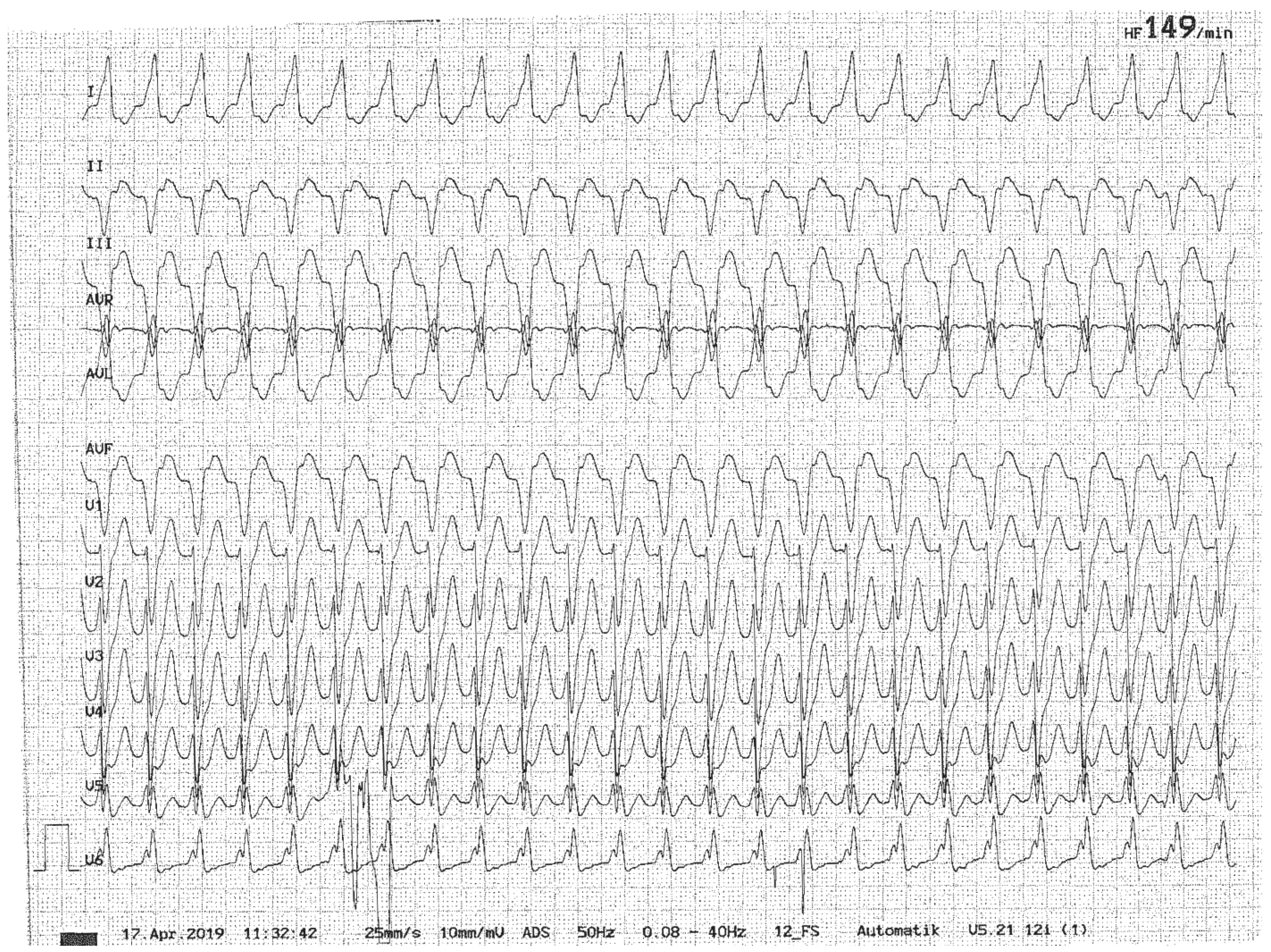 Brainsci 15 00995 g001 Brainsci 15 00995 g001