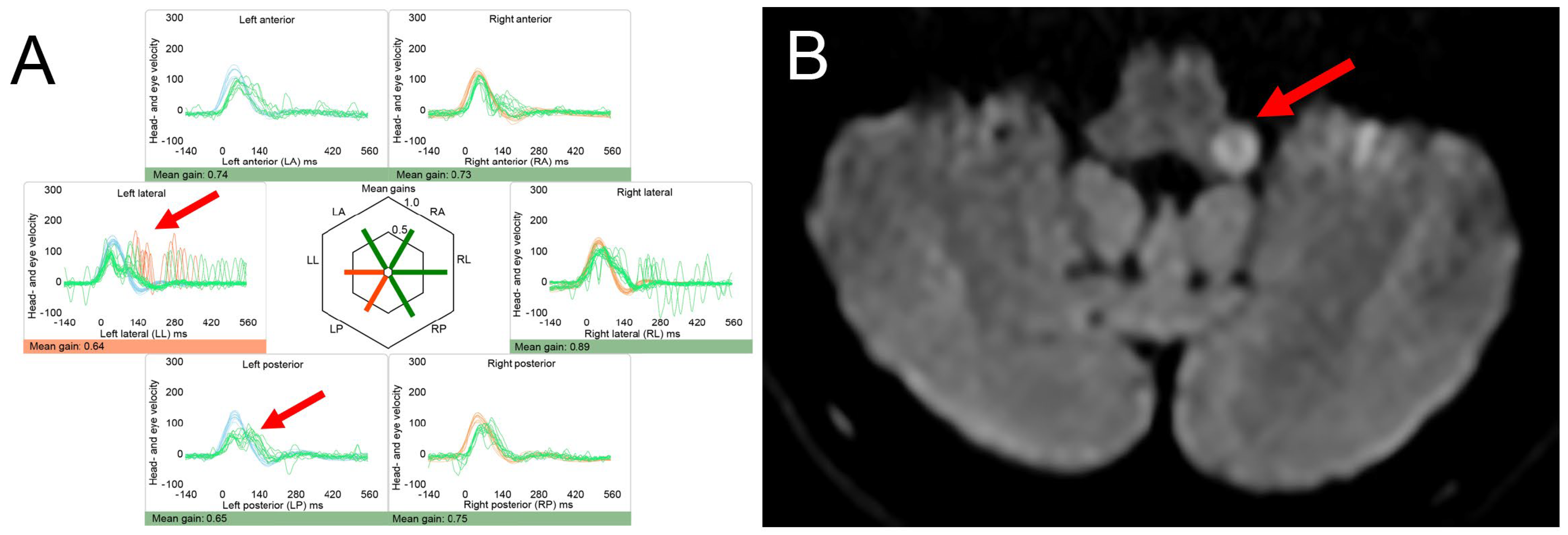Brainsci 15 00995 g002 Brainsci 15 00995 g002