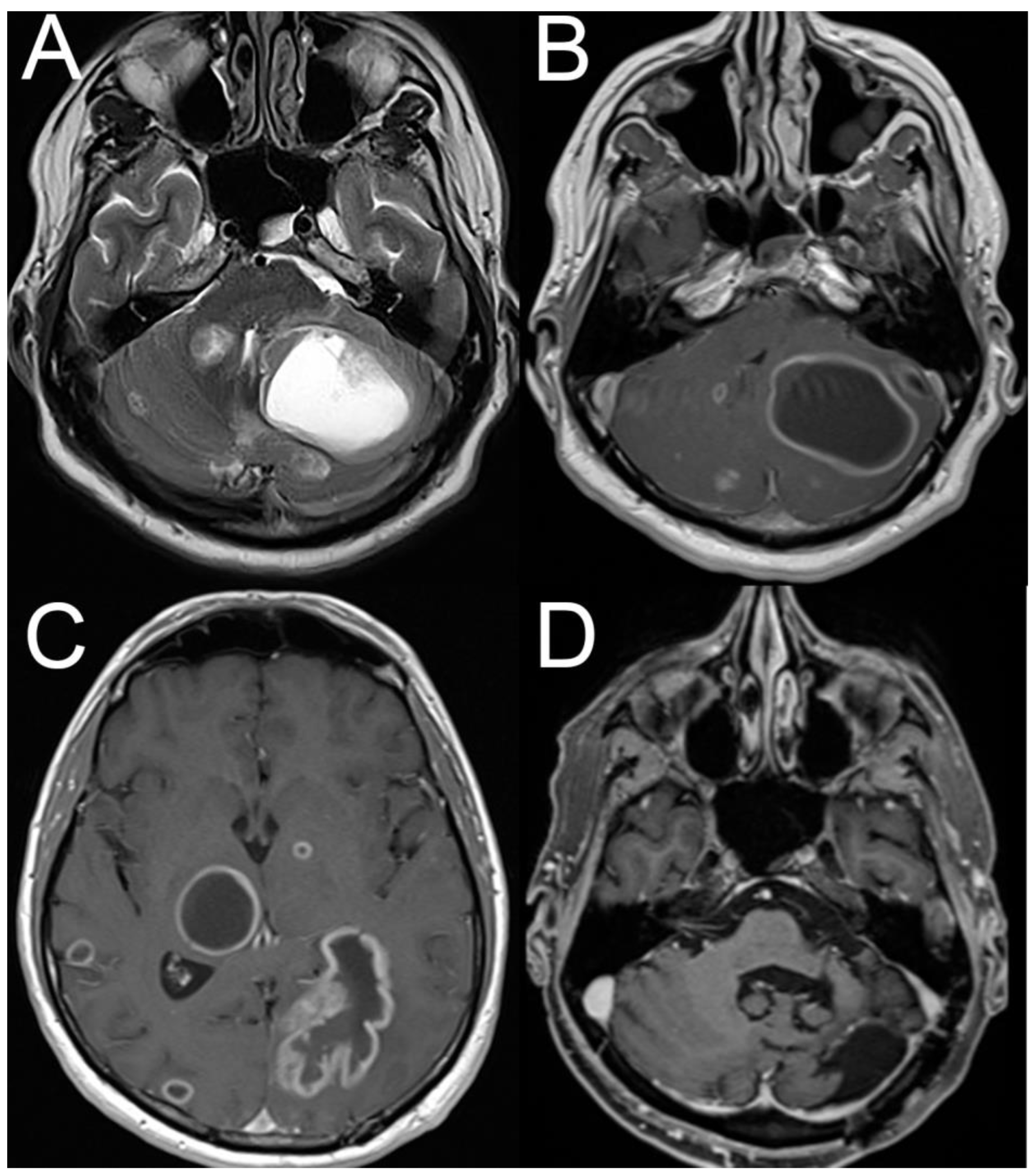 Brainsci 15 00995 g003 Brainsci 15 00995 g003