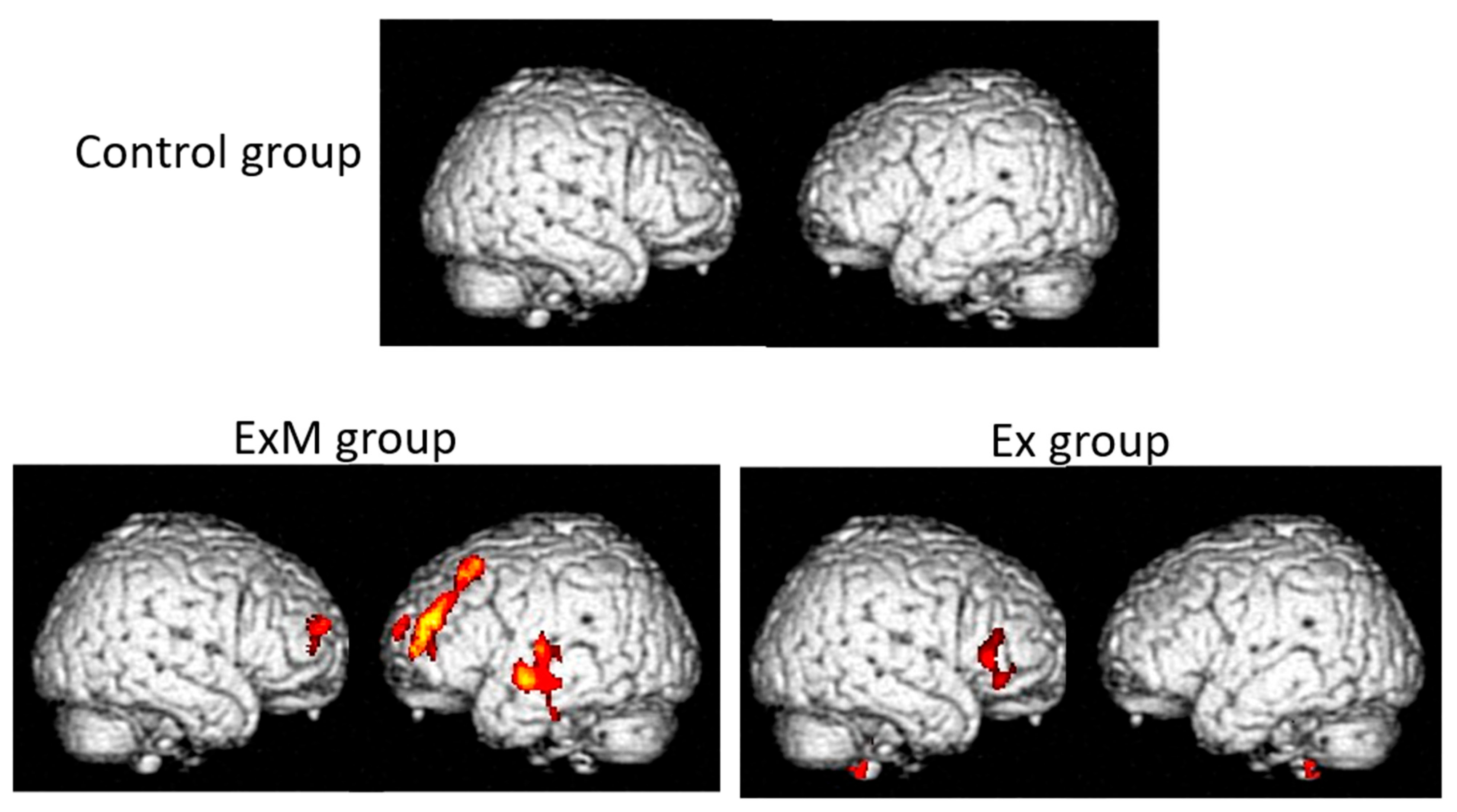 Brainsci 15 00999 g002 Brainsci 15 00999 g002