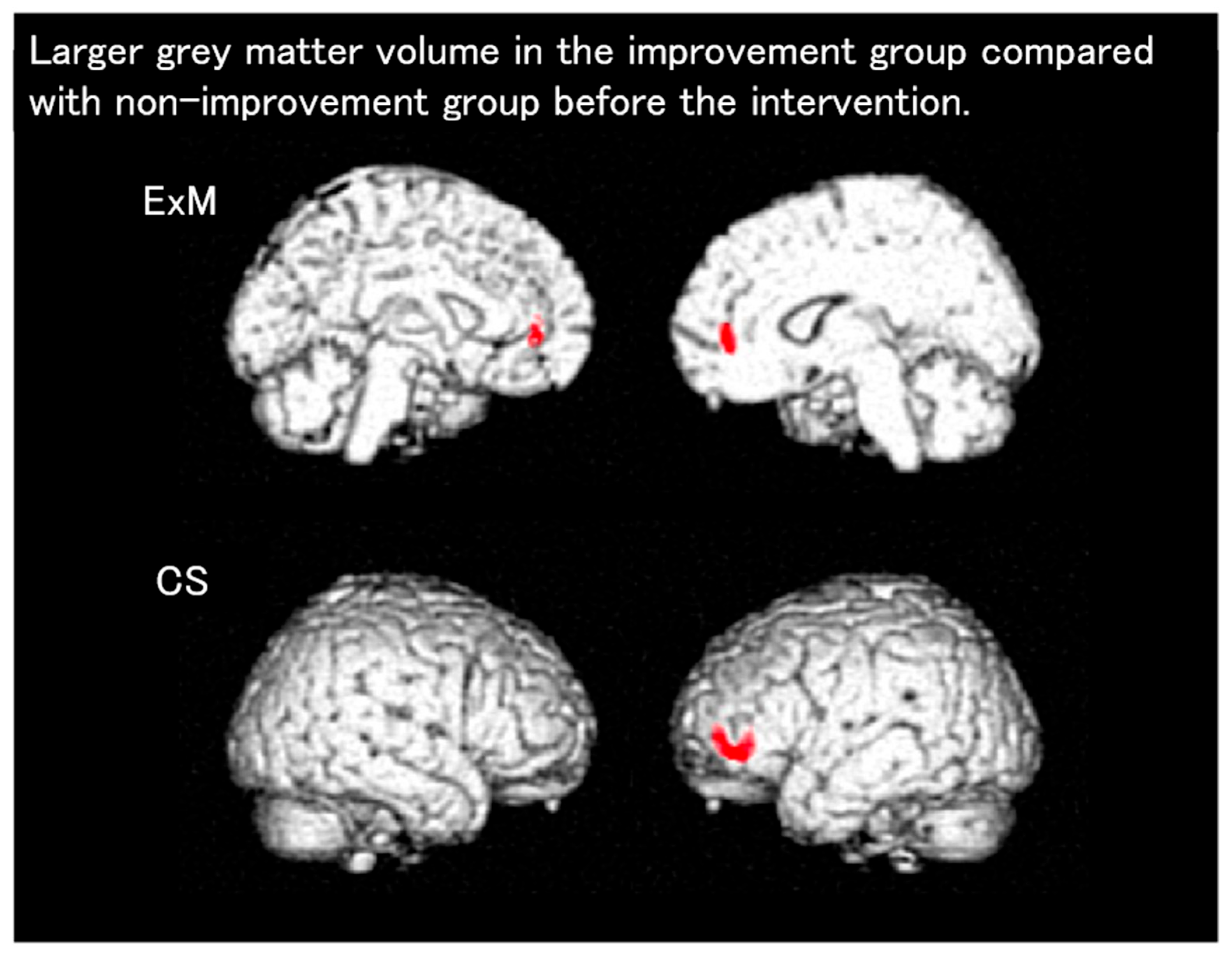Brainsci 15 00999 g003 Brainsci 15 00999 g003