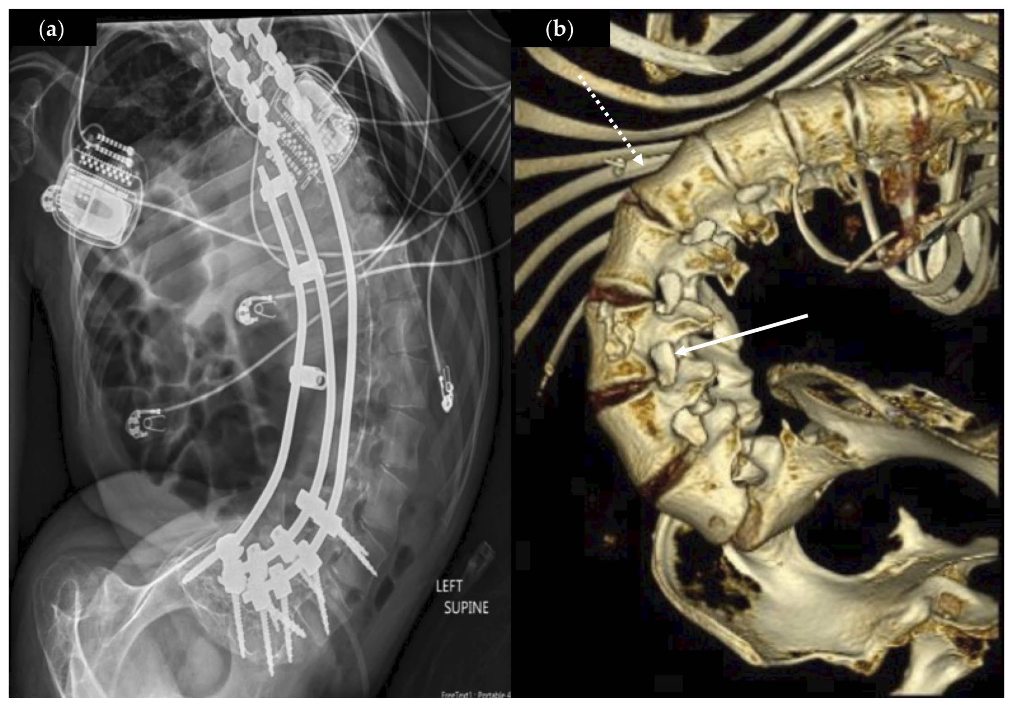 Brainsci 15 01030 g003 Brainsci 15 01030 g003
