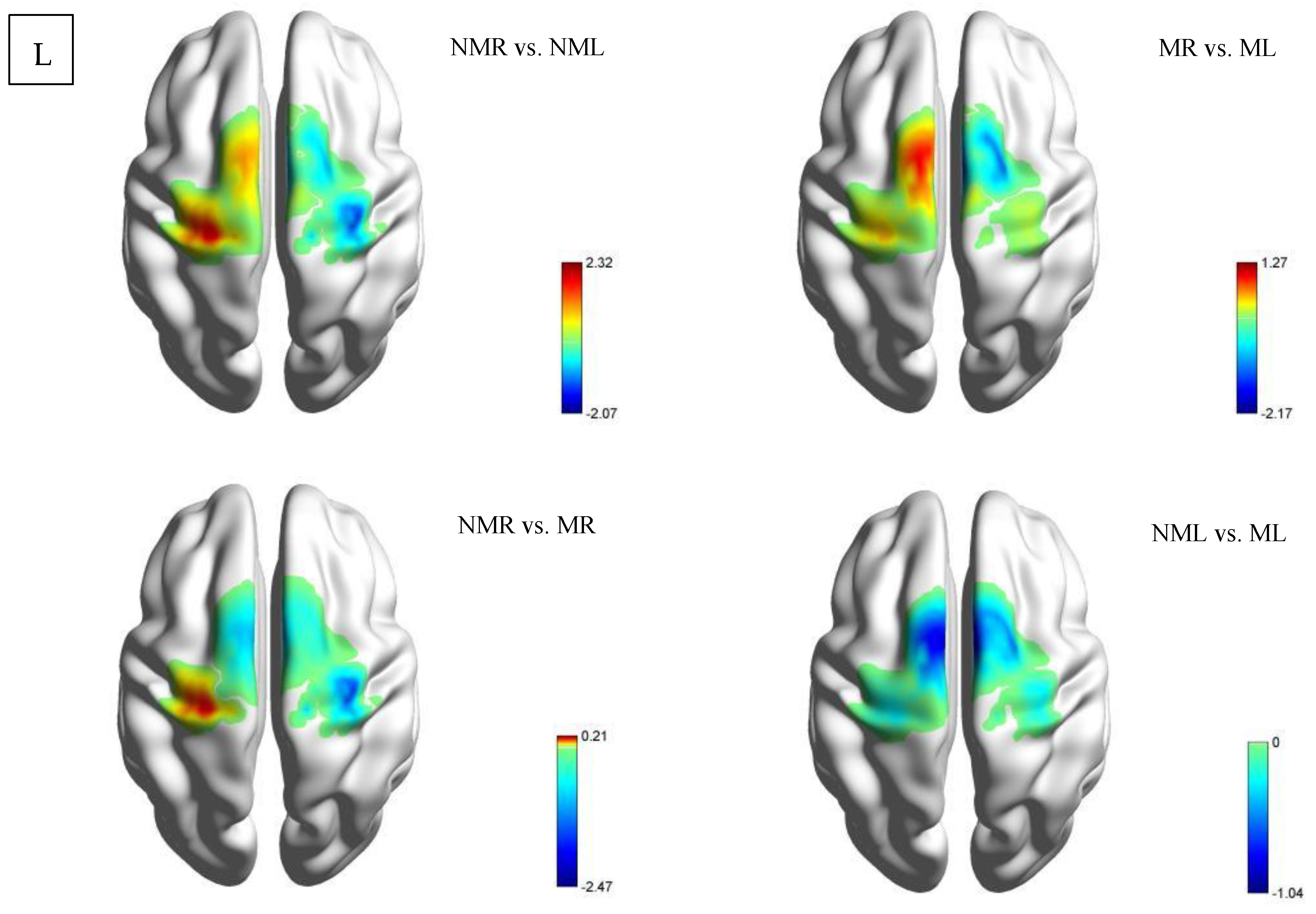 Brainsci 15 01031 g005 Brainsci 15 01031 g005