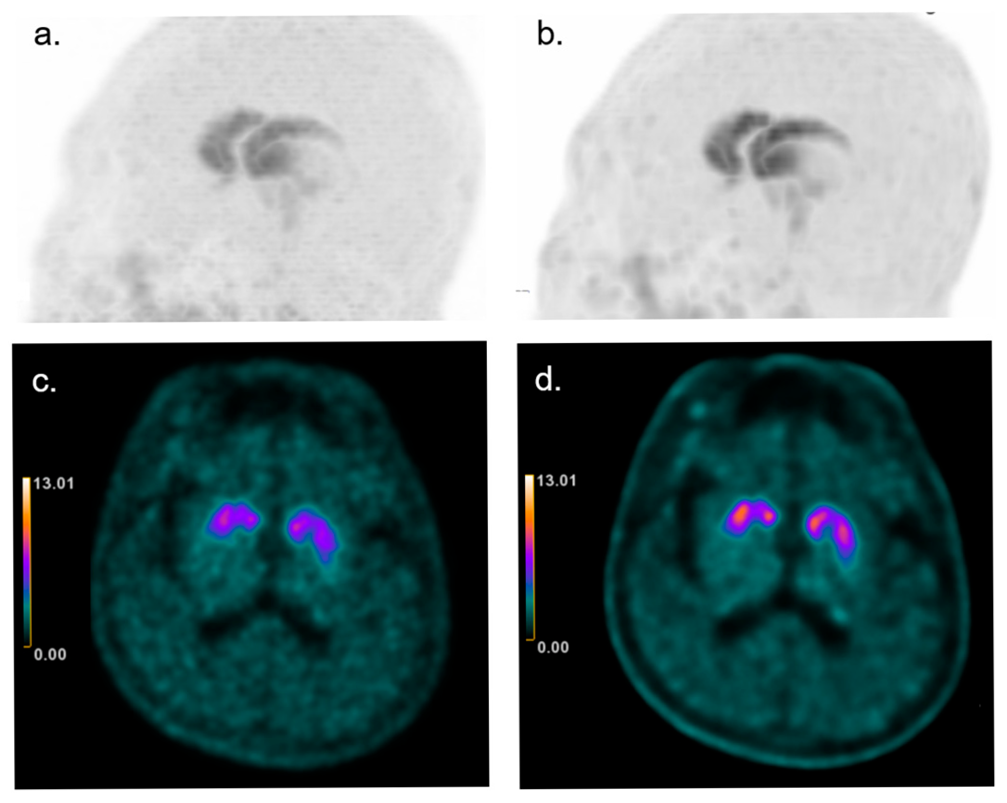 Brainsci 15 01036 g008
