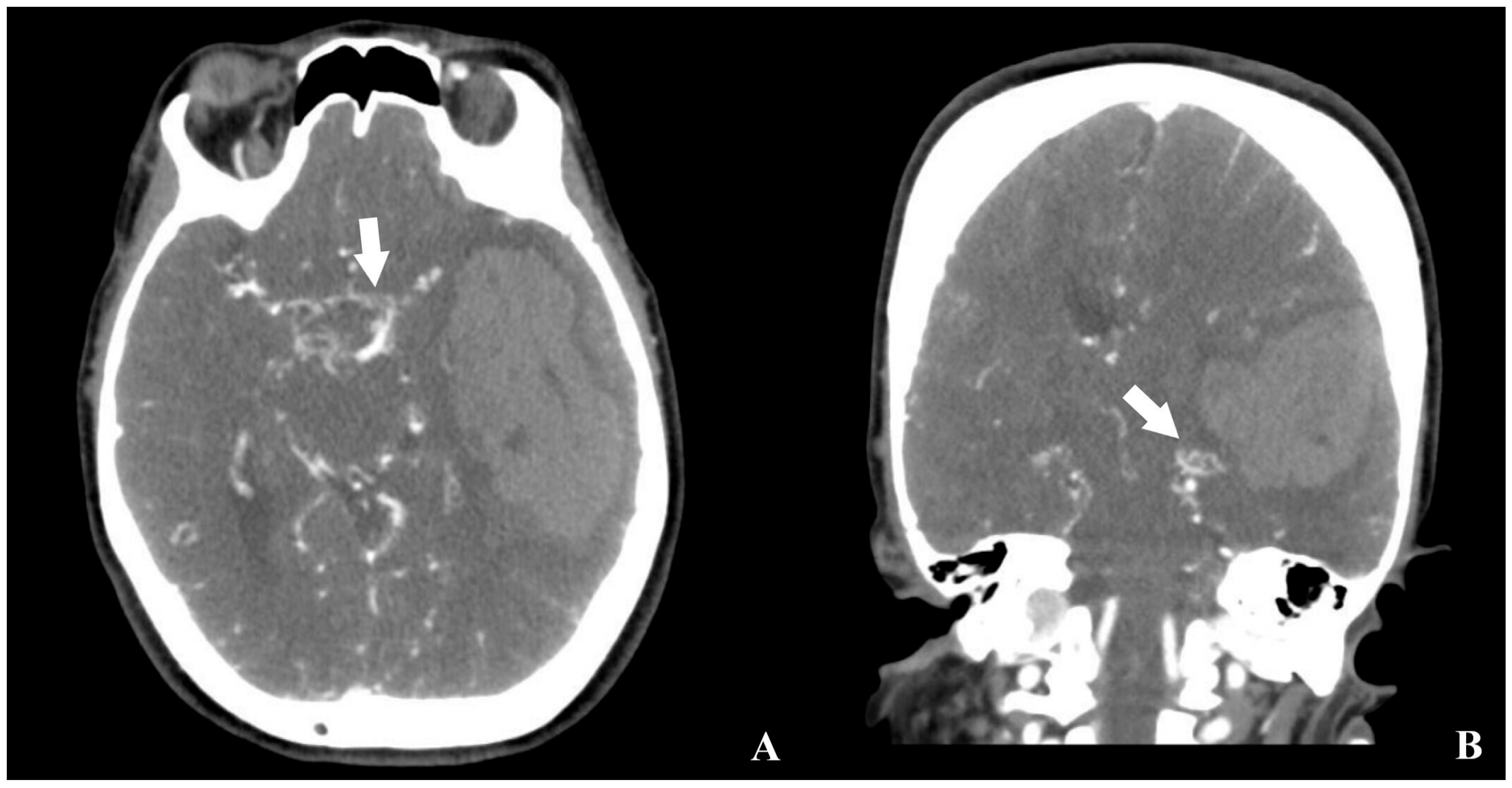 Brainsci 15 01077 g002