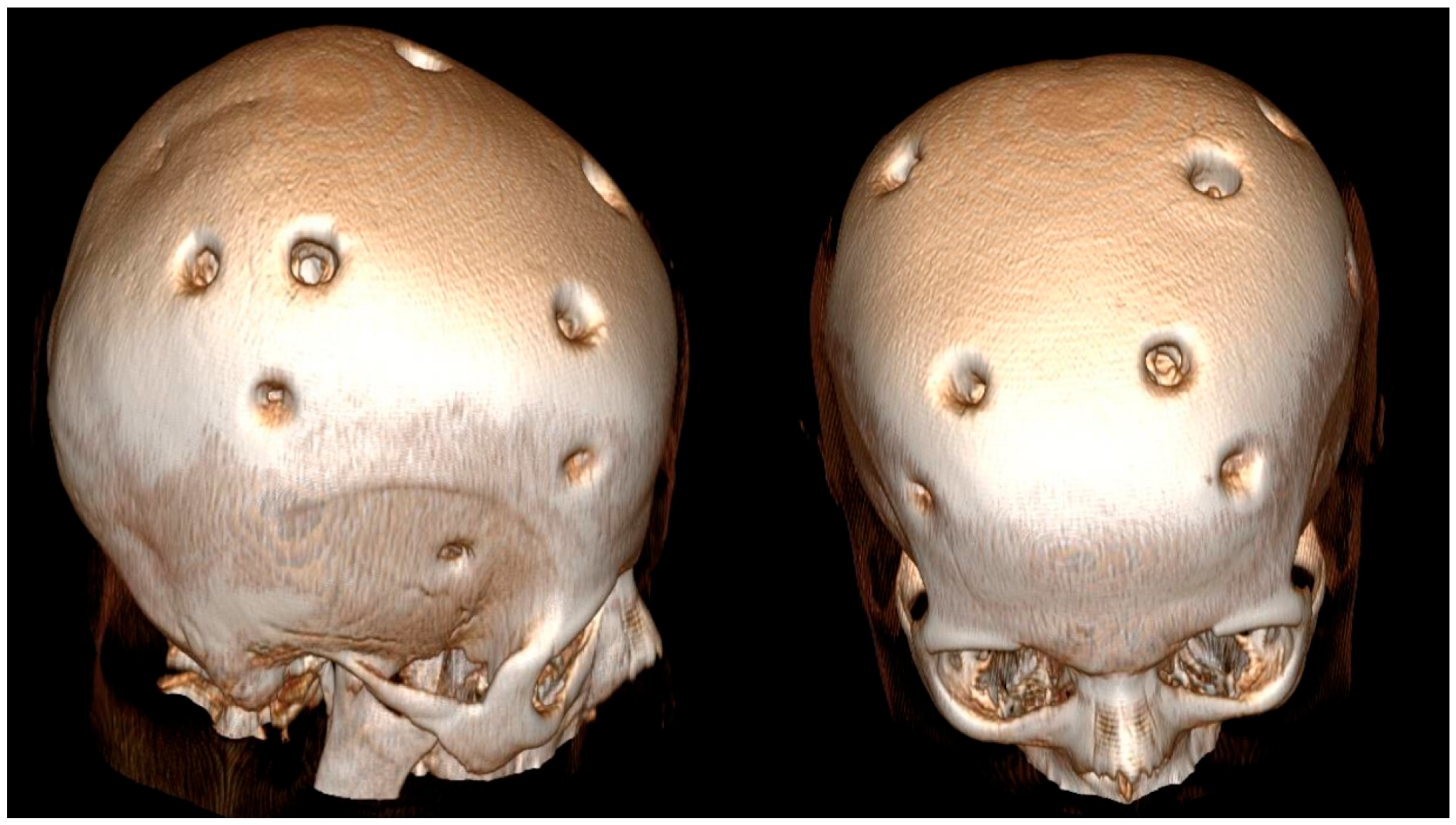 Brainsci 15 01077 g004