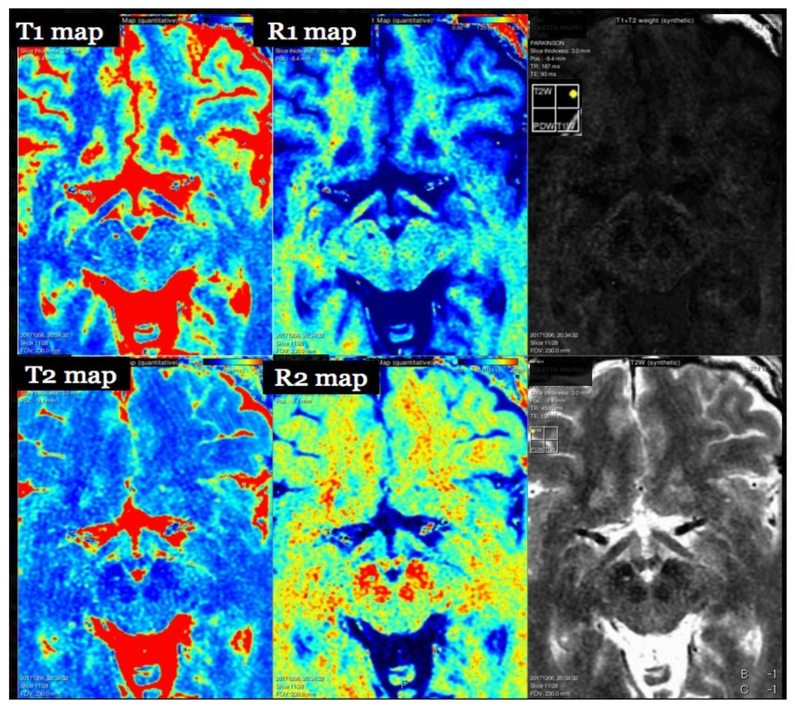 Brainsci 15 01088 g001 Brainsci 15 01088 g001