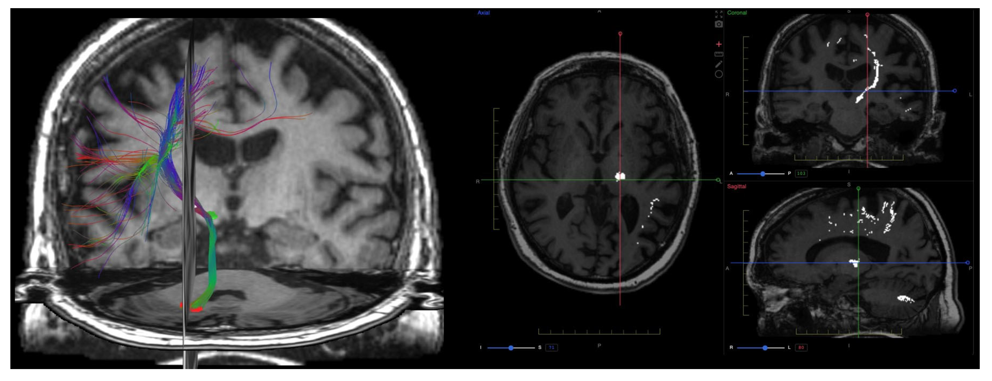 Brainsci 15 01088 g002 Brainsci 15 01088 g002