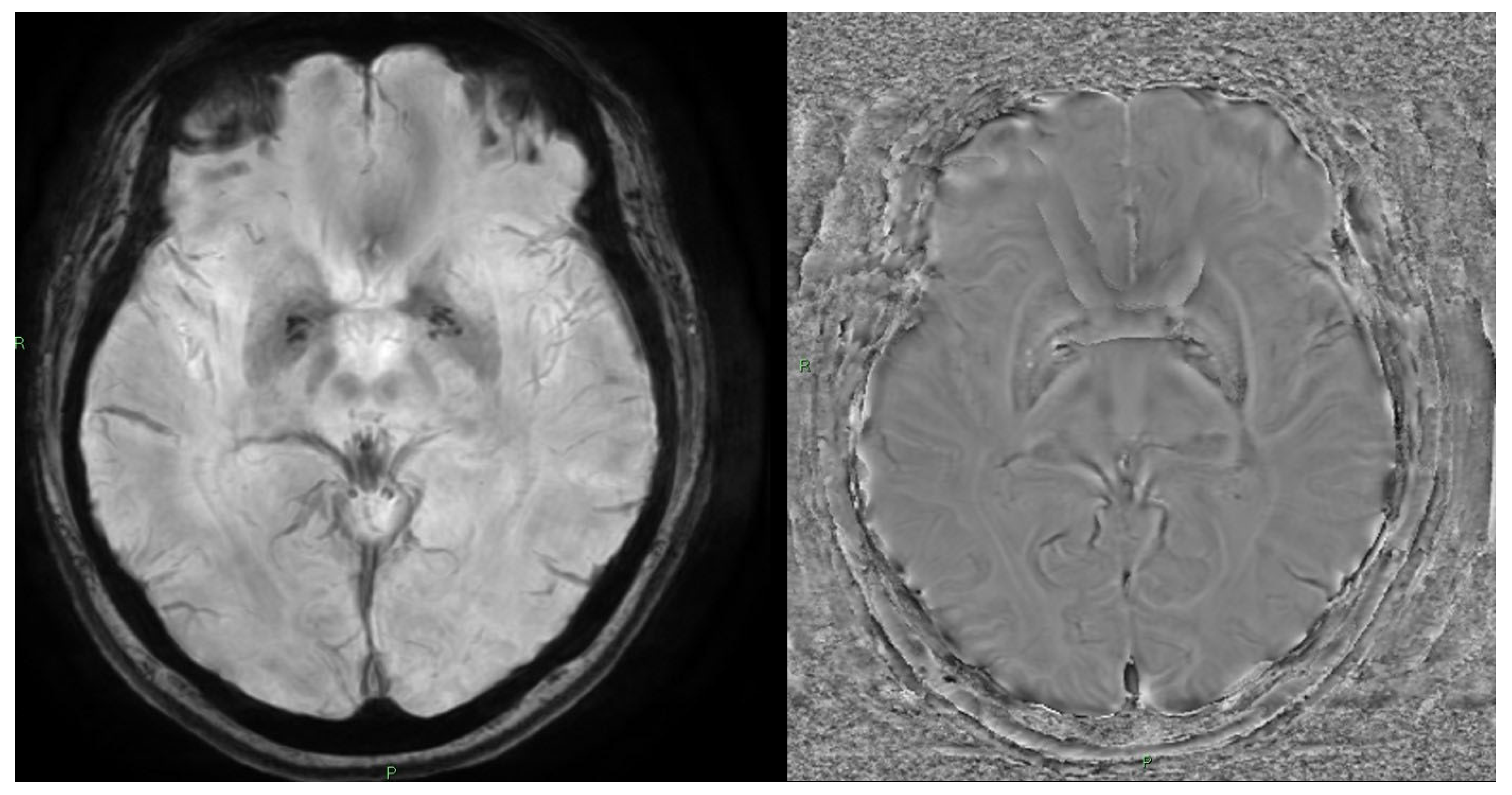 Brainsci 15 01088 g003 Brainsci 15 01088 g003