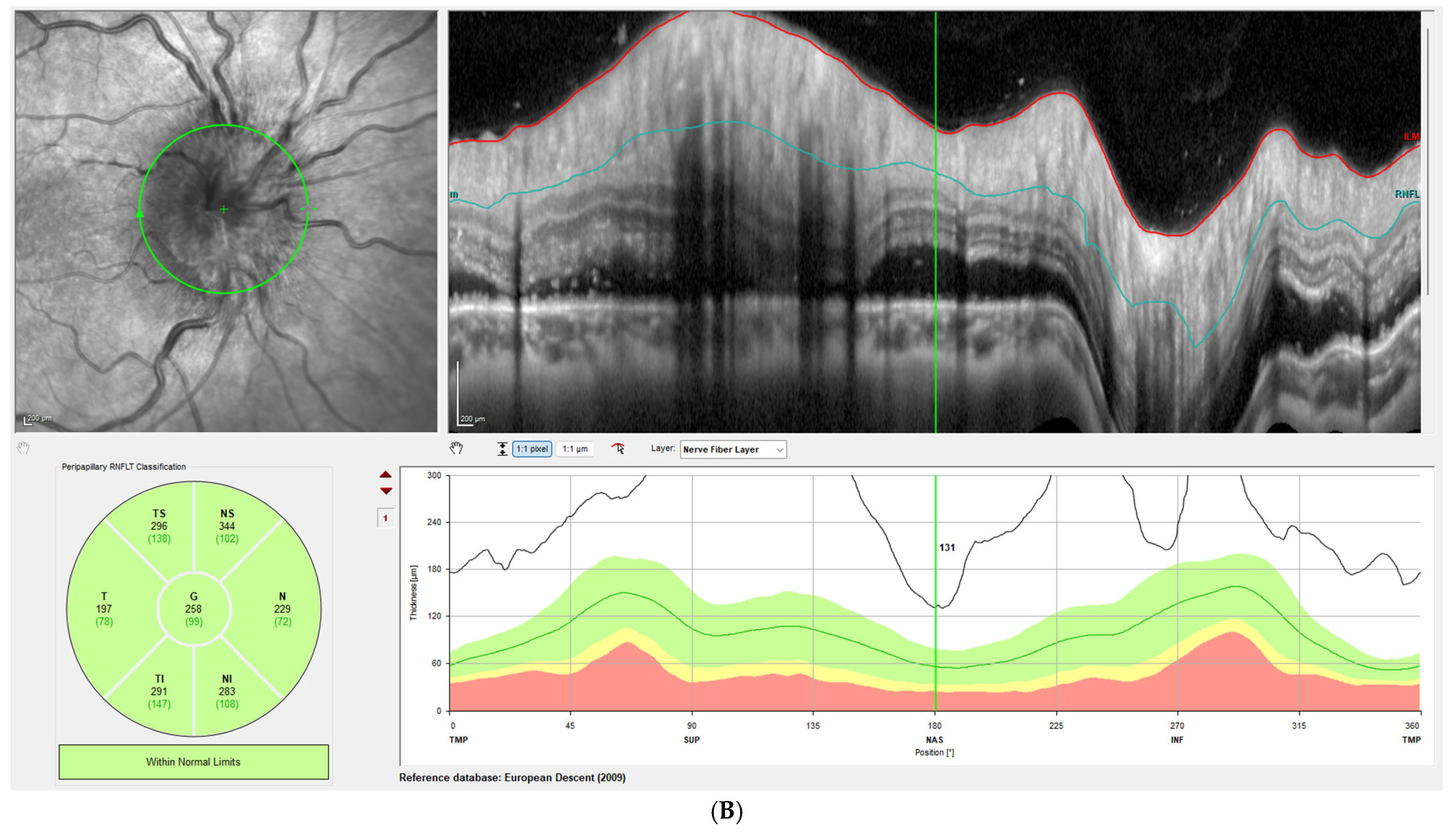 Brainsci 15 01099 g001b