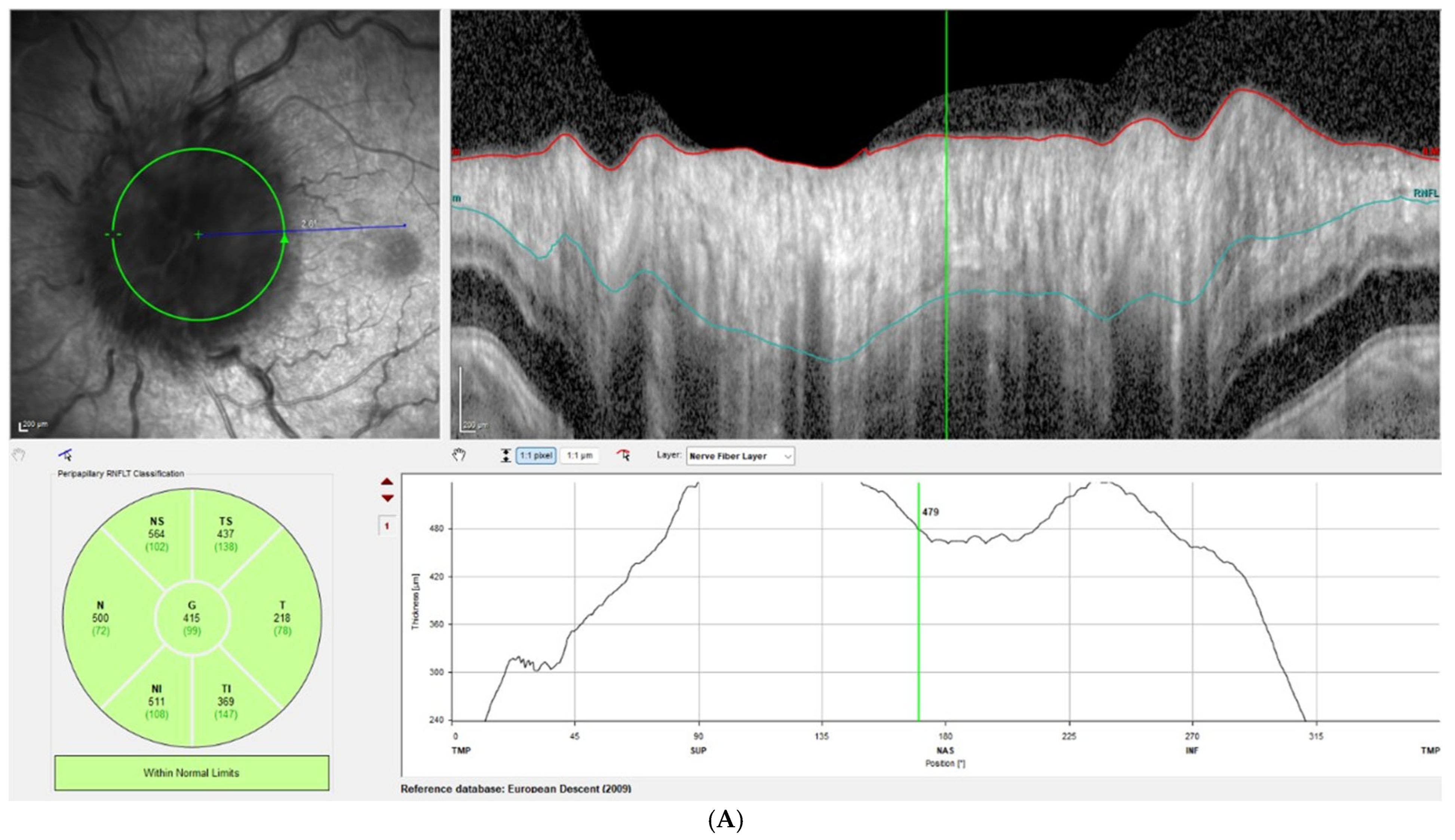 Brainsci 15 01099 g002a