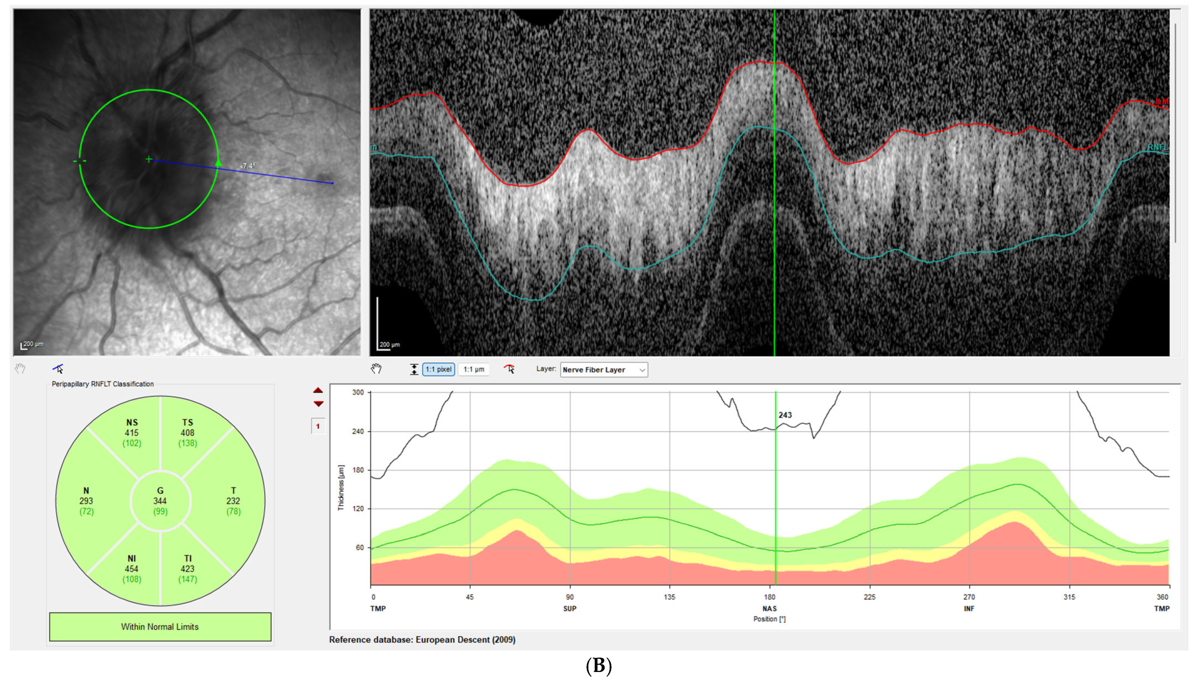 Brainsci 15 01099 g002b