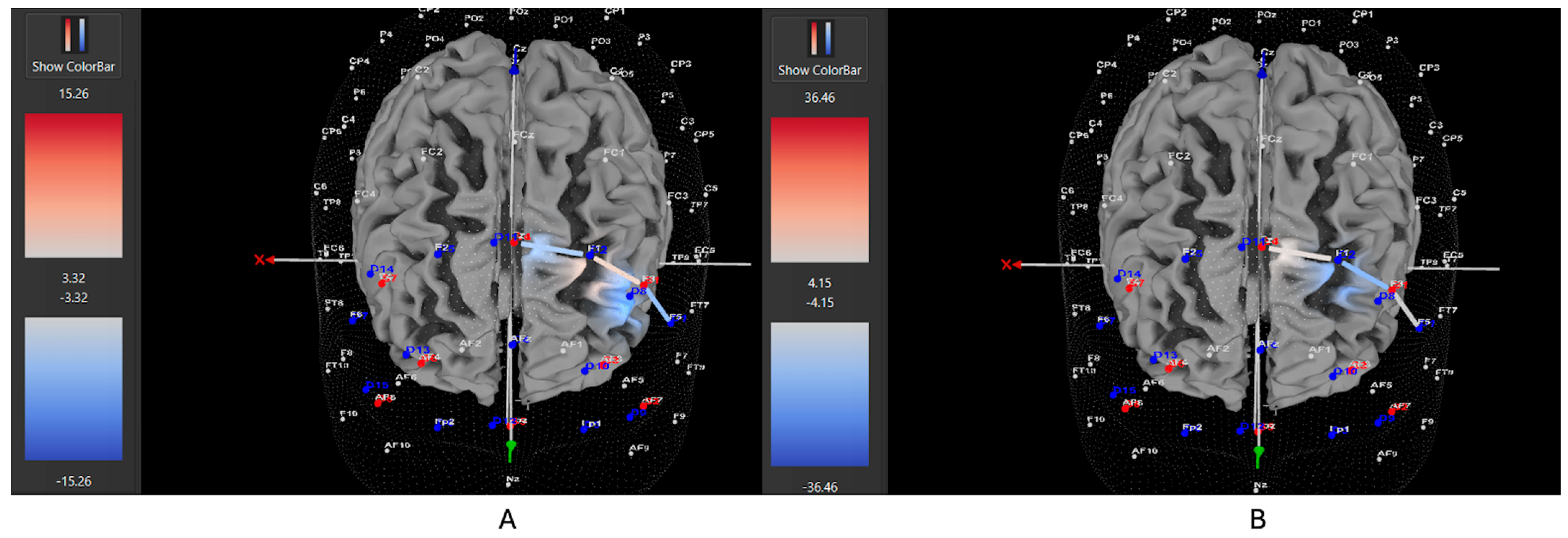 Brainsci 15 01107 g005 Brainsci 15 01107 g005