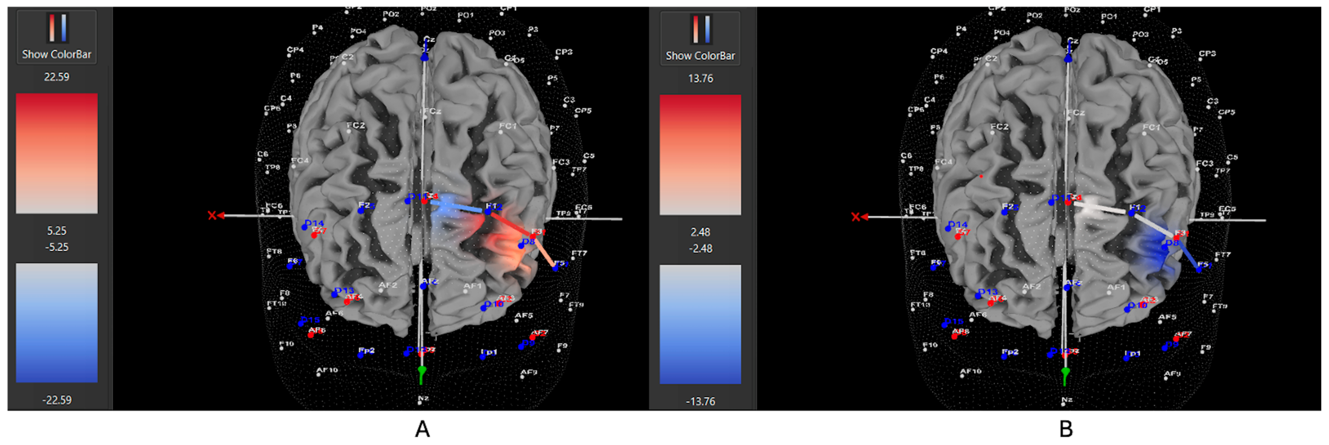 Brainsci 15 01107 g006 Brainsci 15 01107 g006