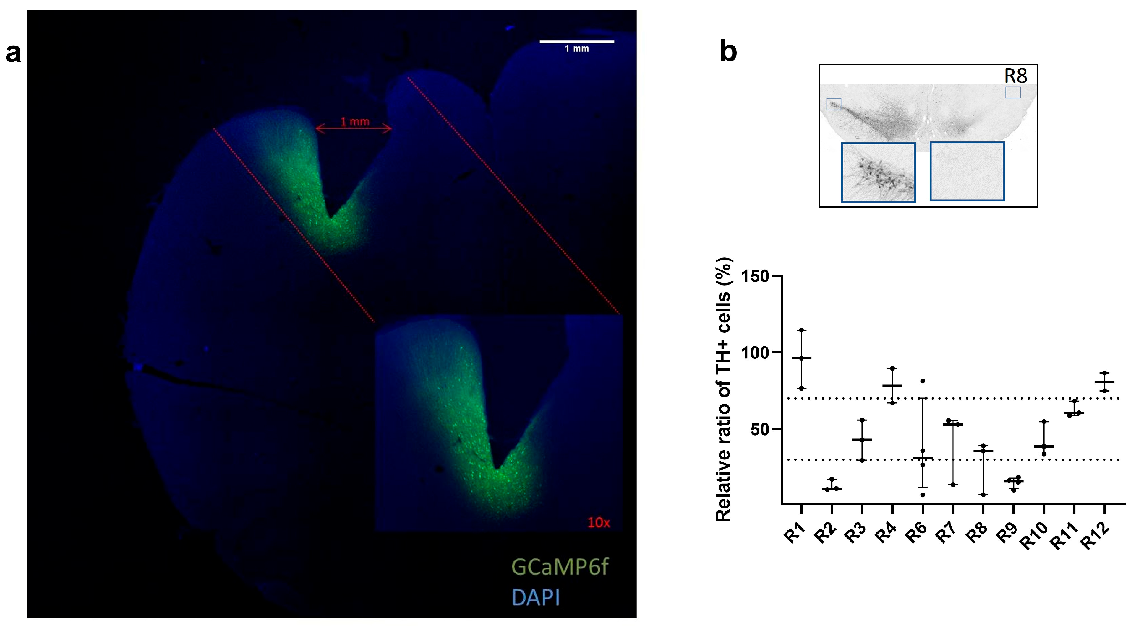Brainsci 15 01123 g002 Brainsci 15 01123 g002