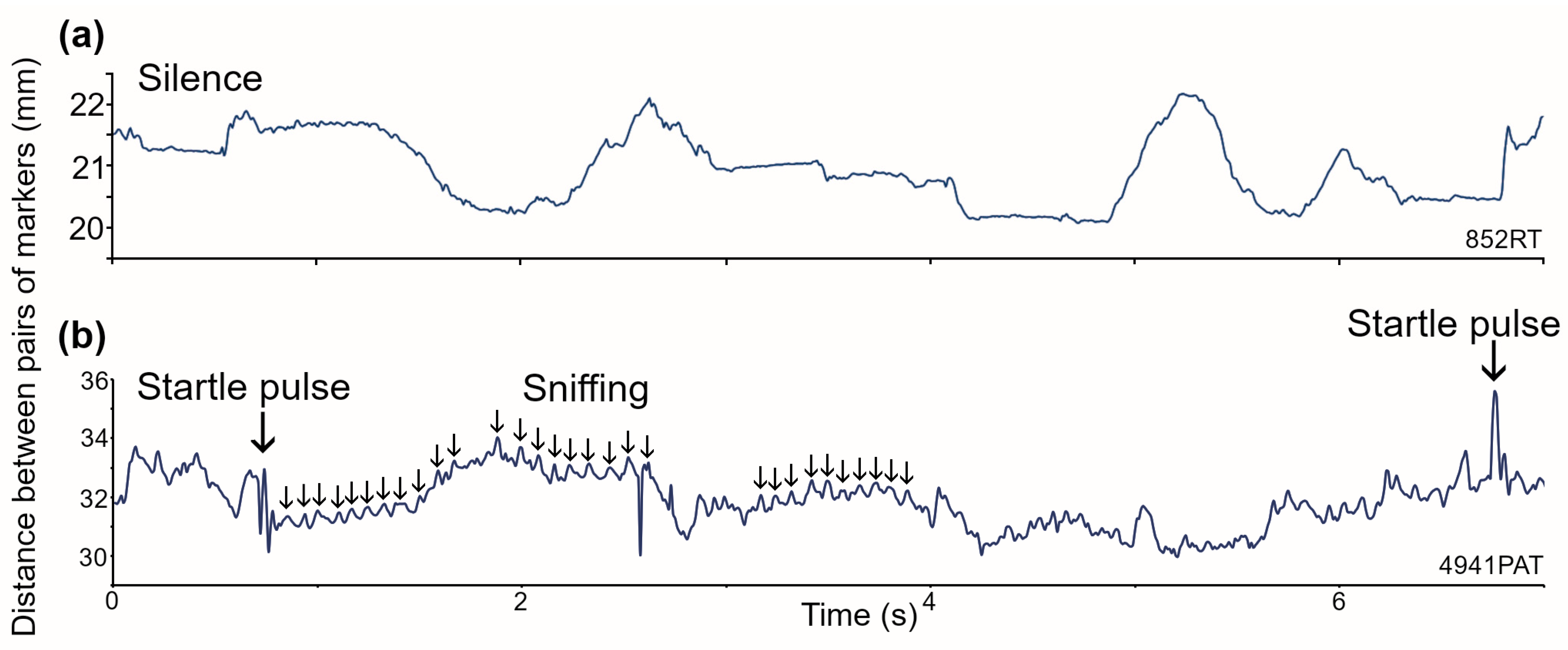 Brainsci 15 01152 g001