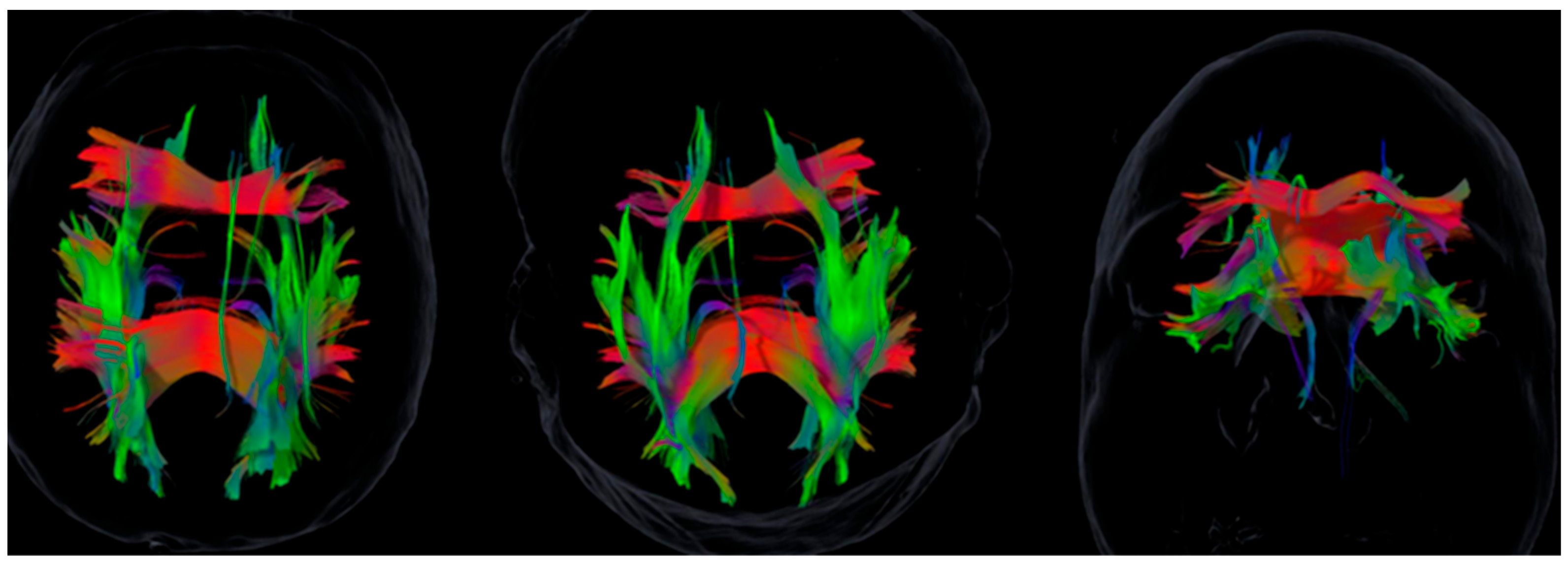 Brainsci 15 01155 g001 Brainsci 15 01155 g001