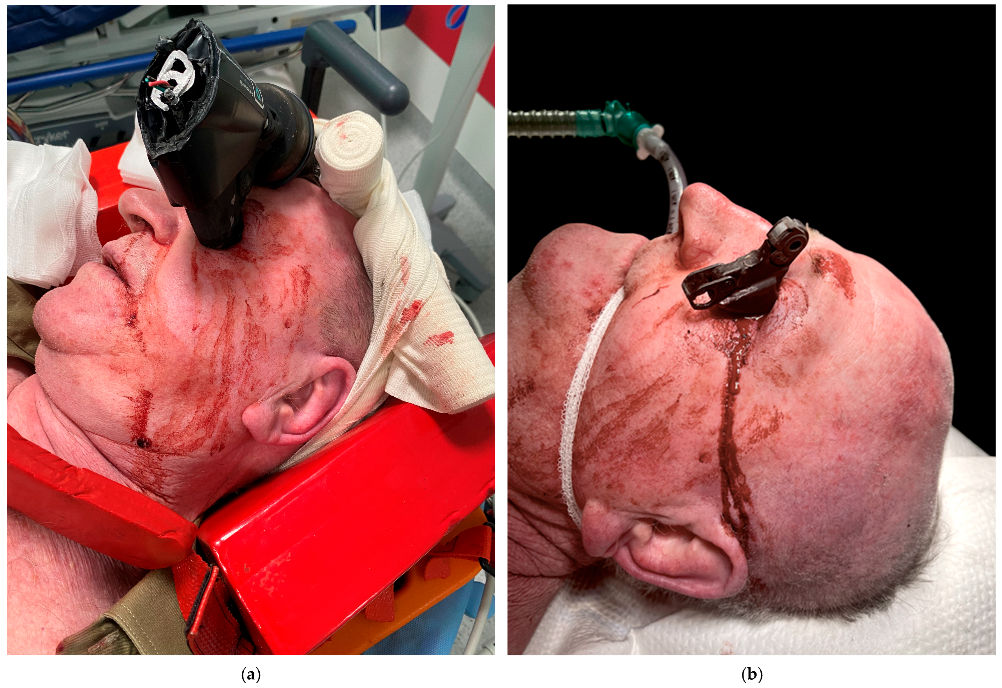 Brainsci 15 01160 g001