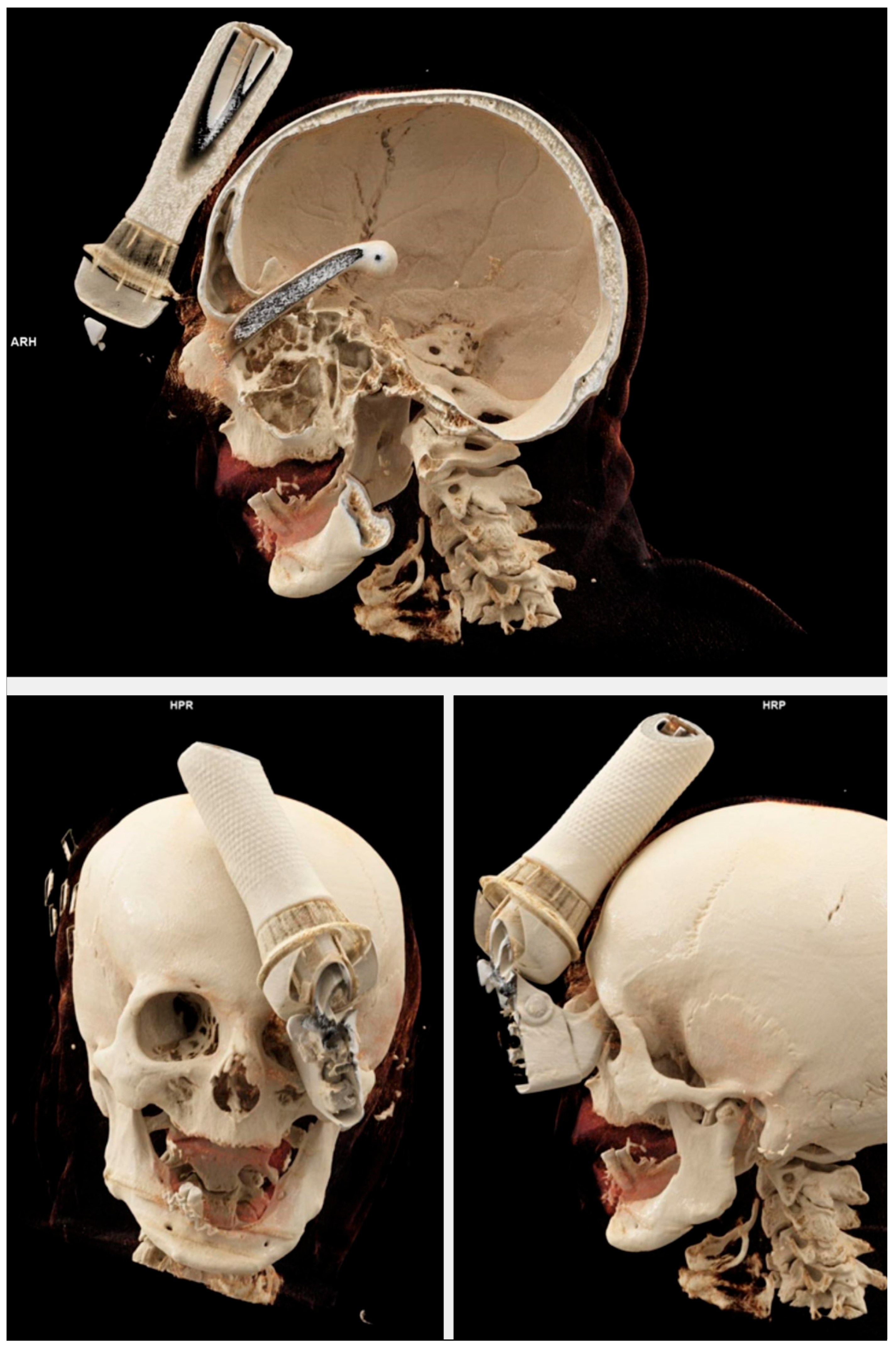 Brainsci 15 01160 g002