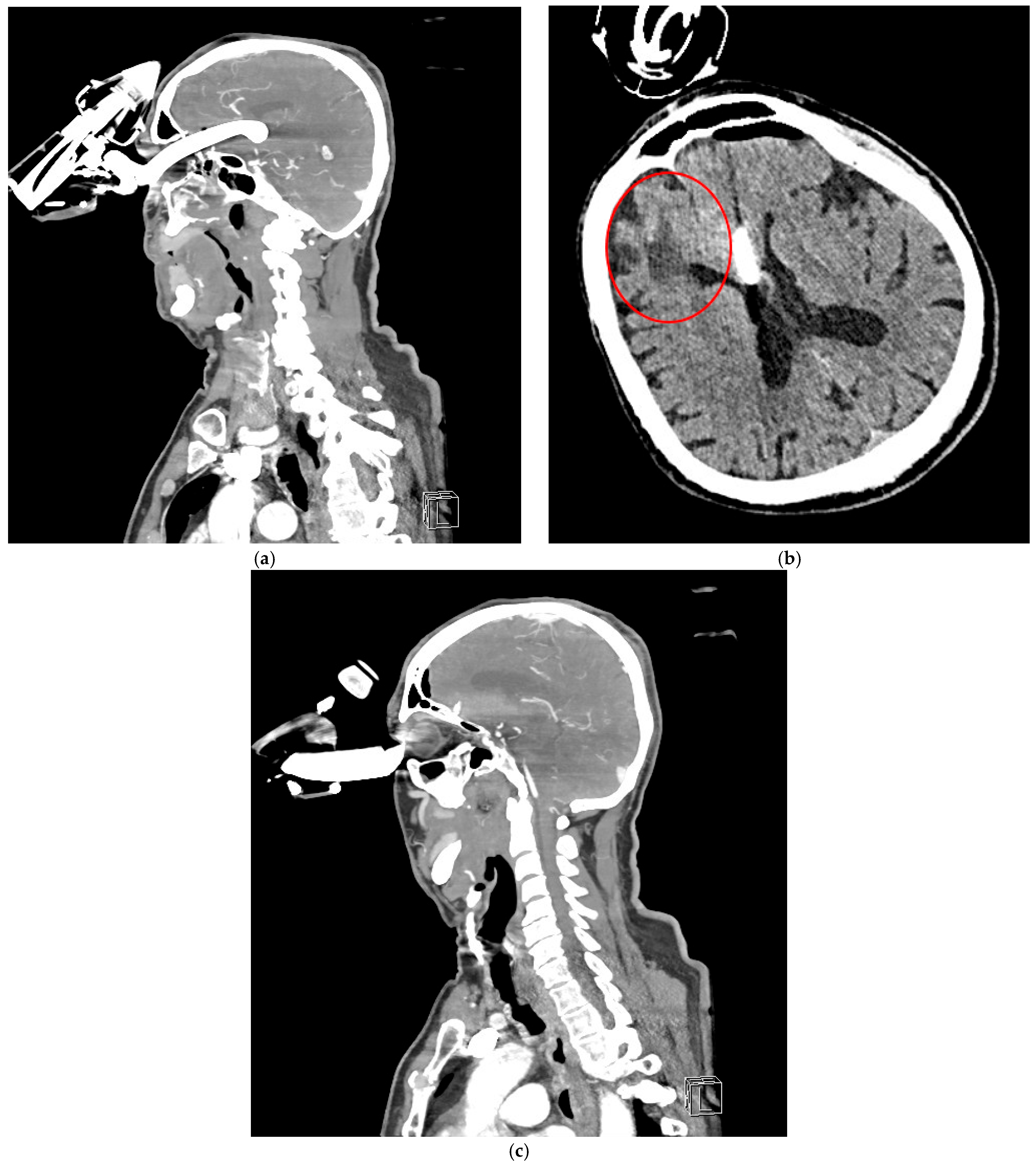 Brainsci 15 01160 g003