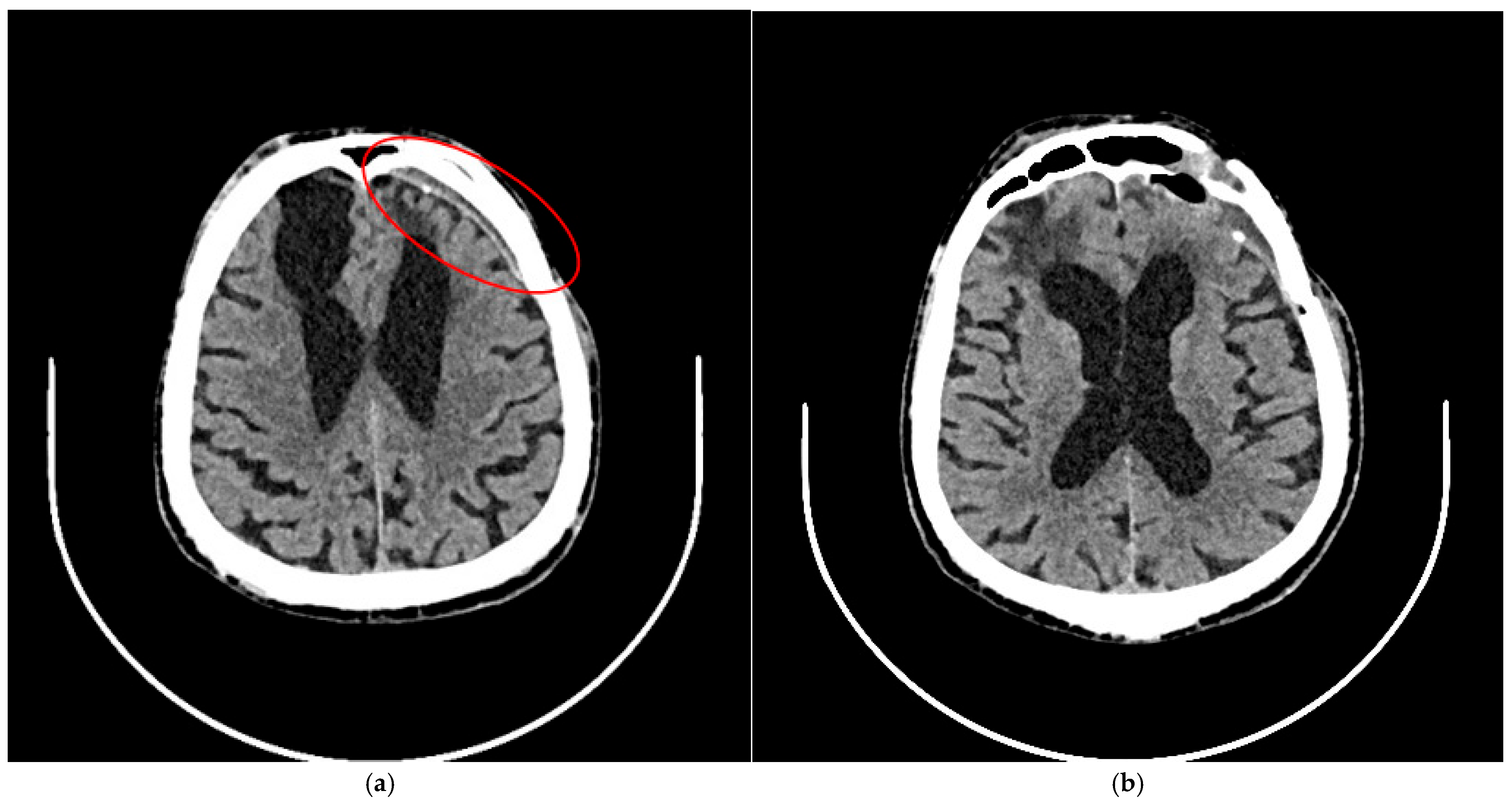 Brainsci 15 01160 g004
