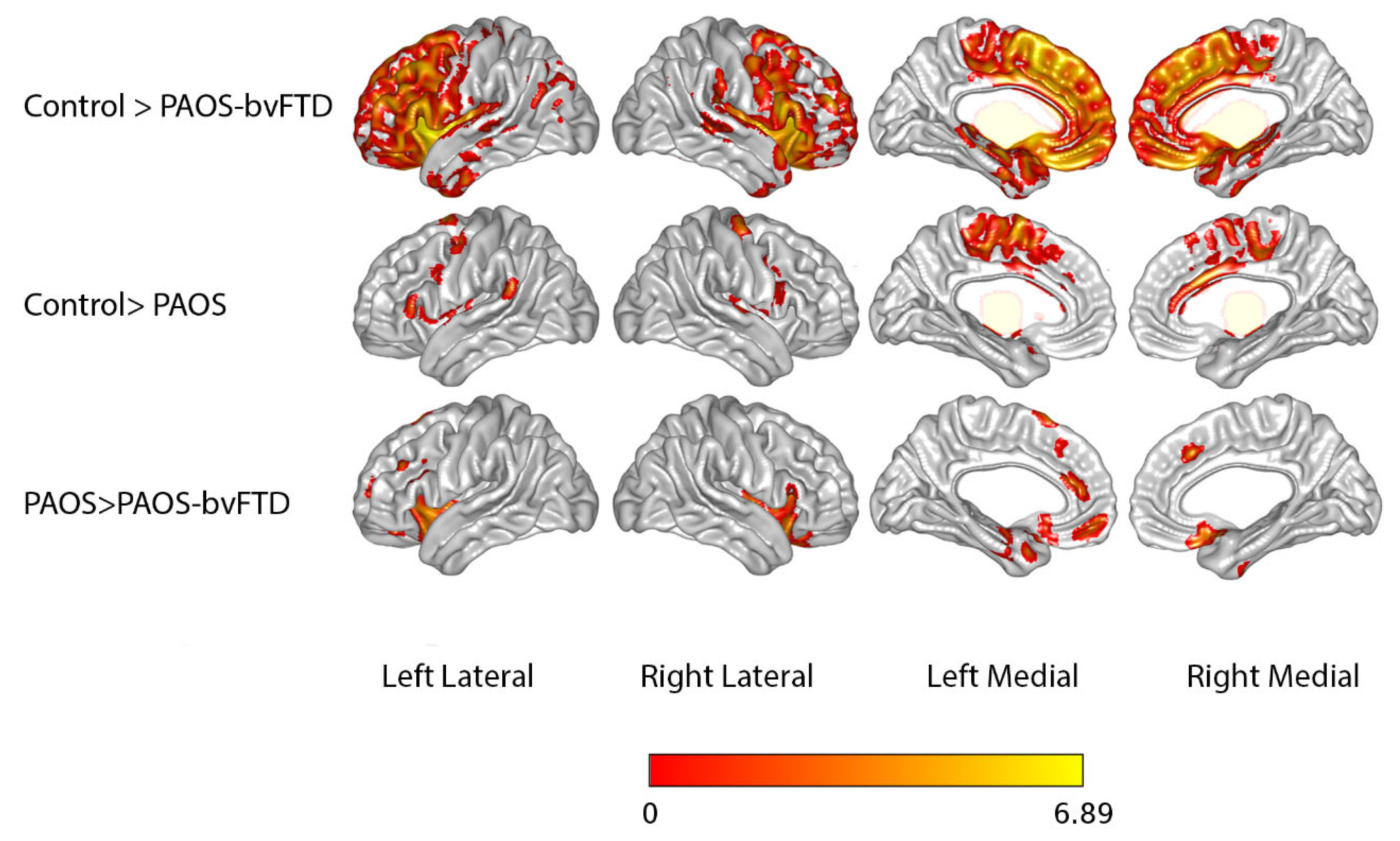 Brainsci 15 01169 g001 Brainsci 15 01169 g001