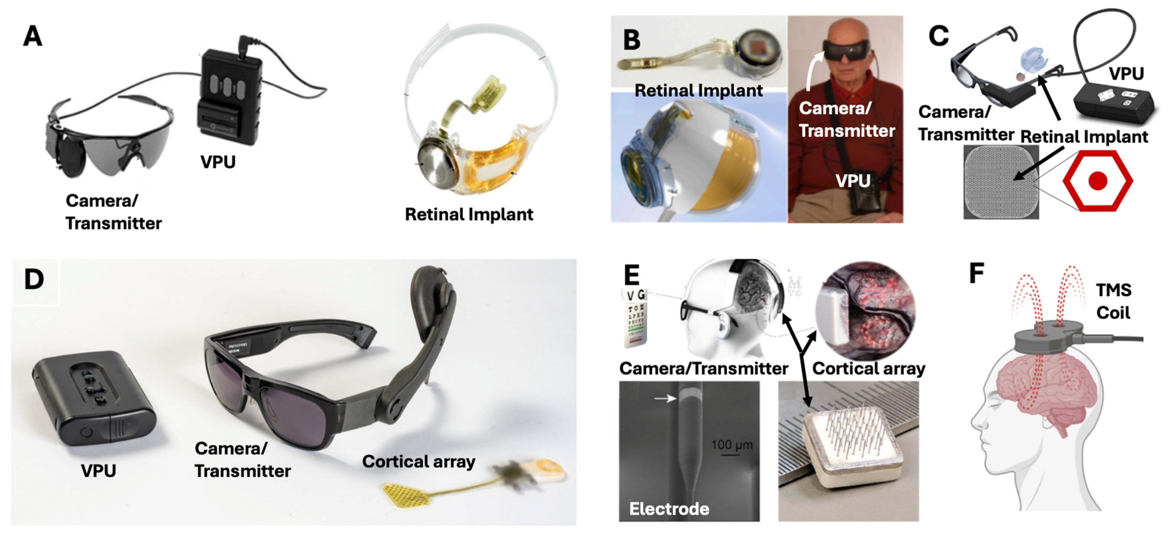 Brainsci 15 01170 g006
