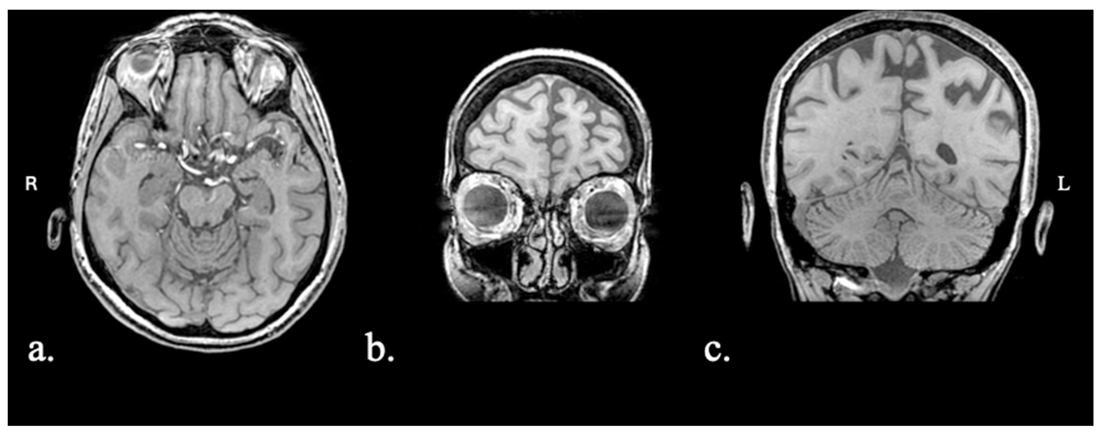 Brainsci 15 01199 g001