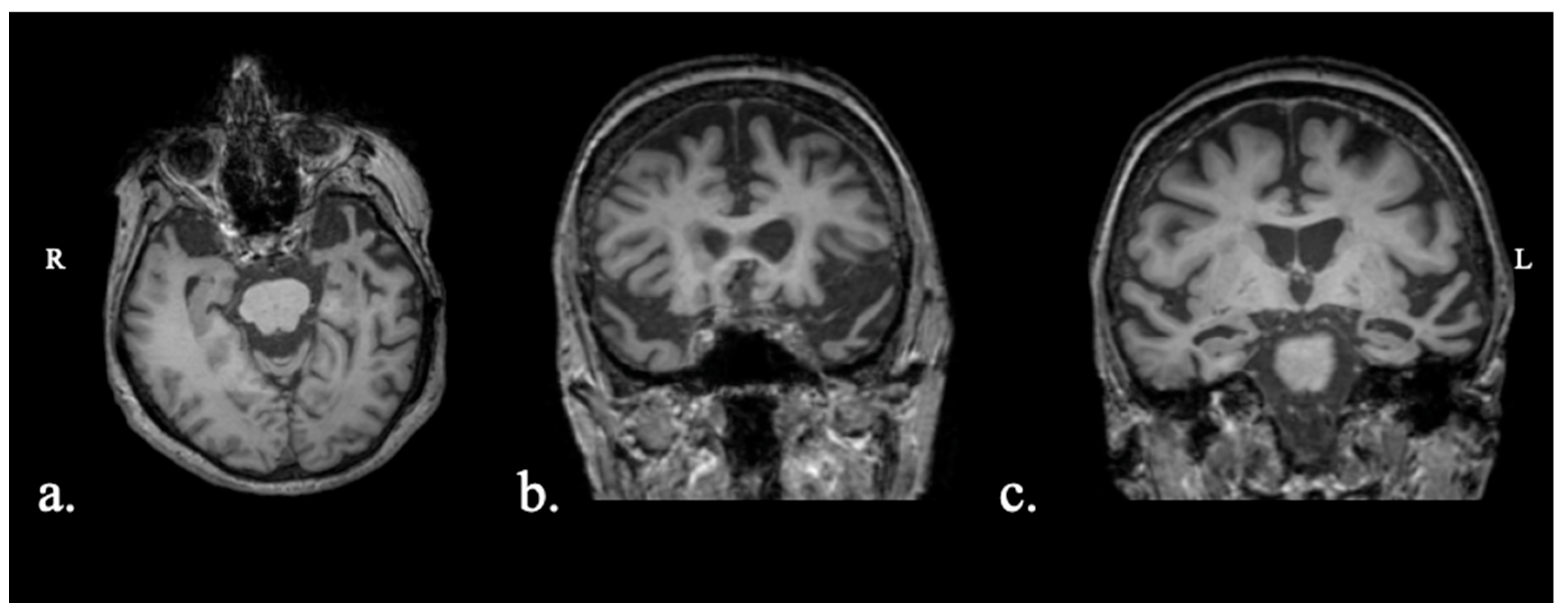 Brainsci 15 01199 g003