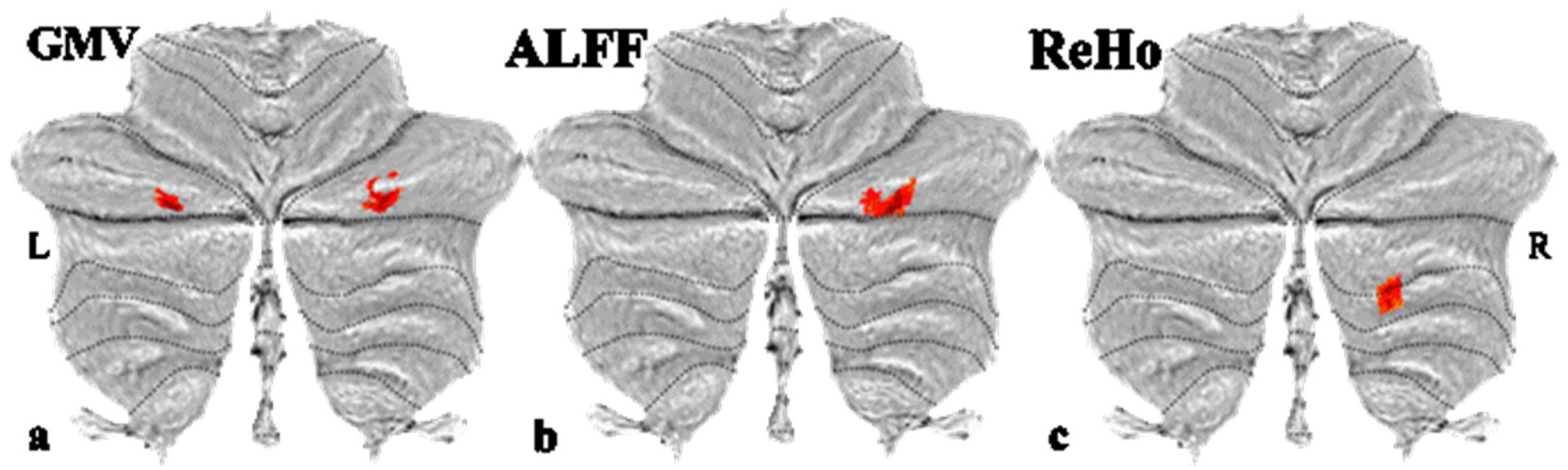 Brainsci 15 01221 g001
