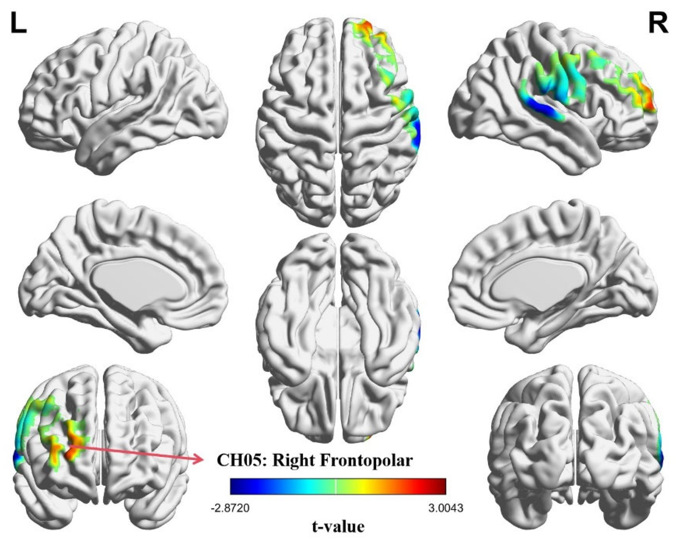Brainsci 15 01235 g004