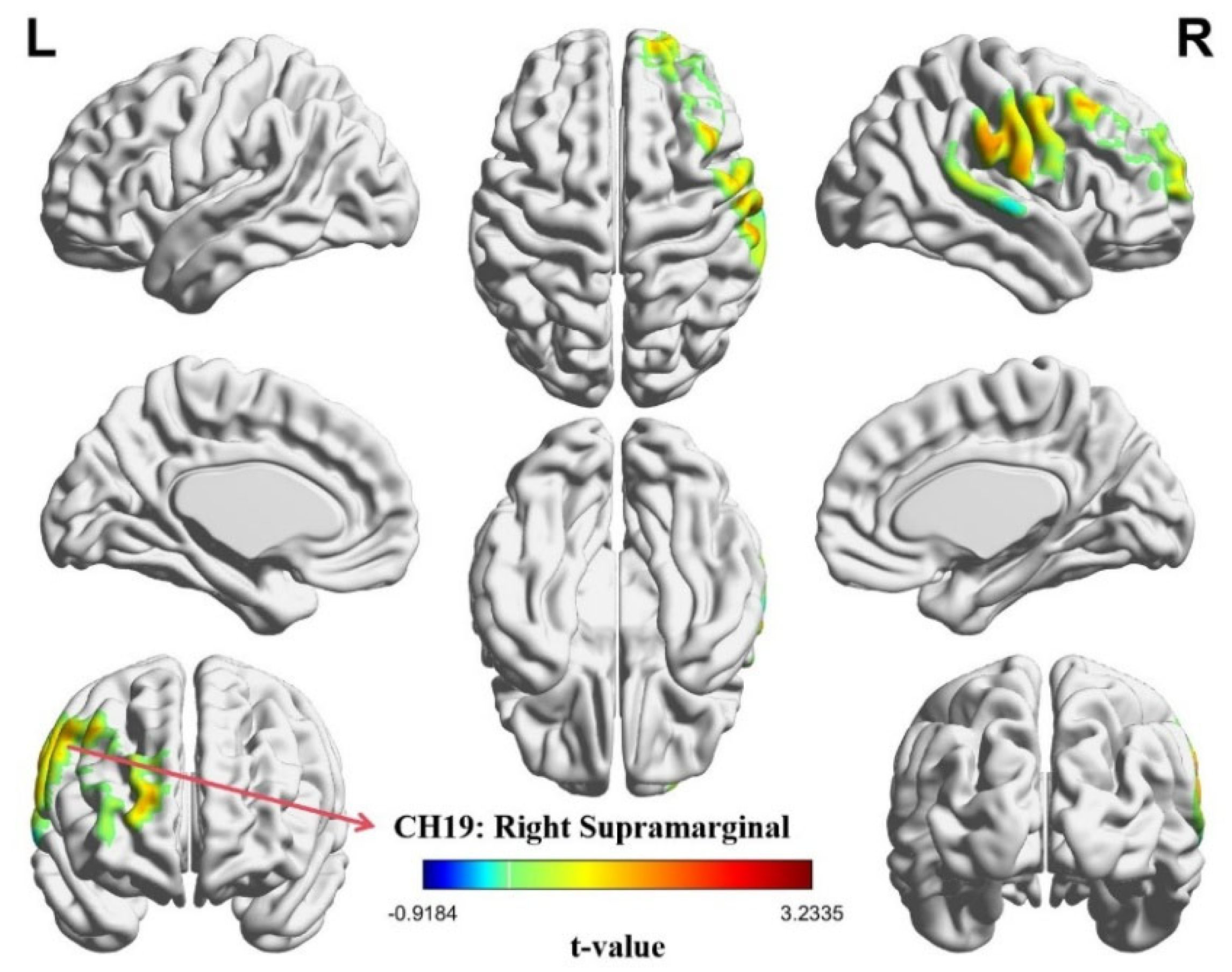 Brainsci 15 01235 g005