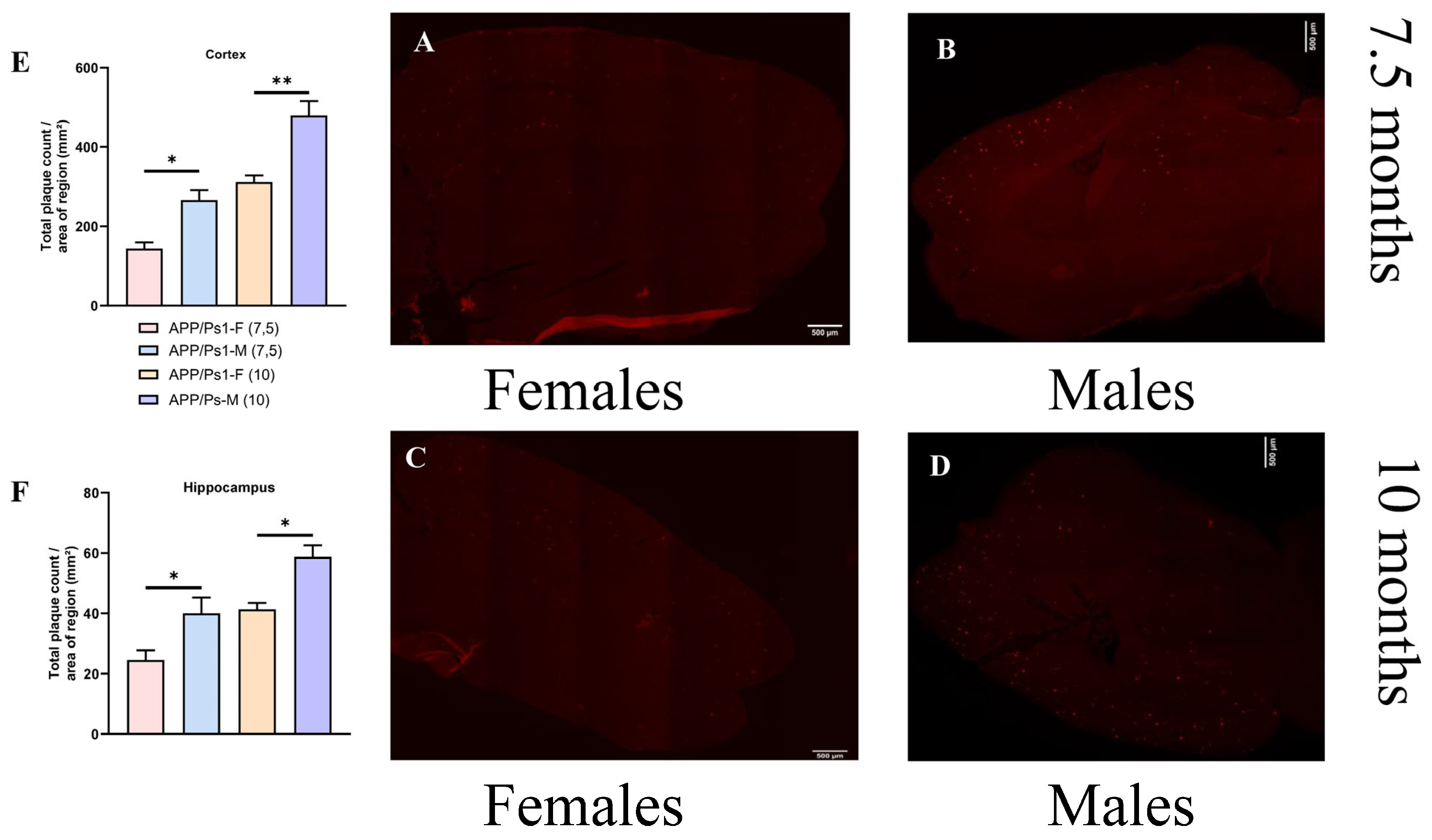 Brainsci 15 01237 g006 Brainsci 15 01237 g006