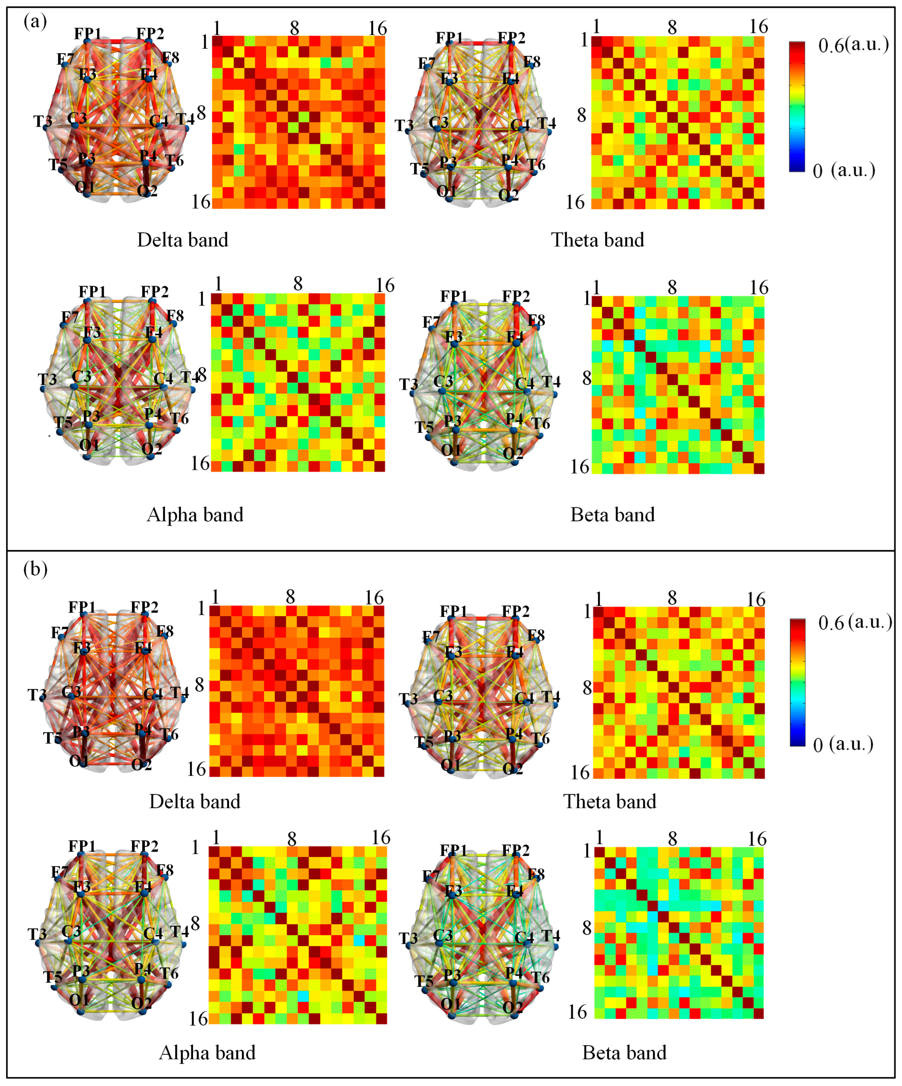 Brainsci 15 01243 g006