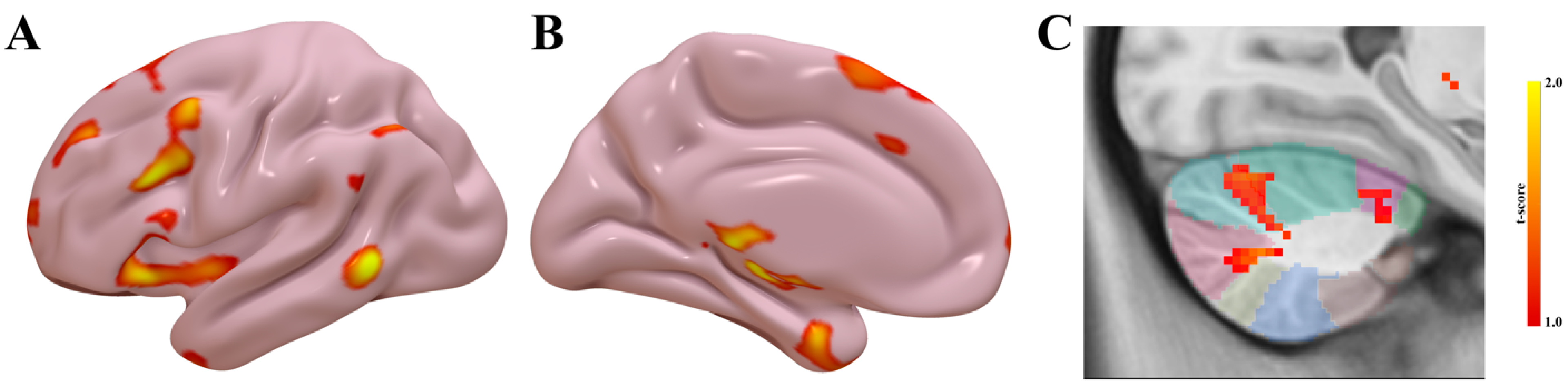 Brainsci 15 01245 g004