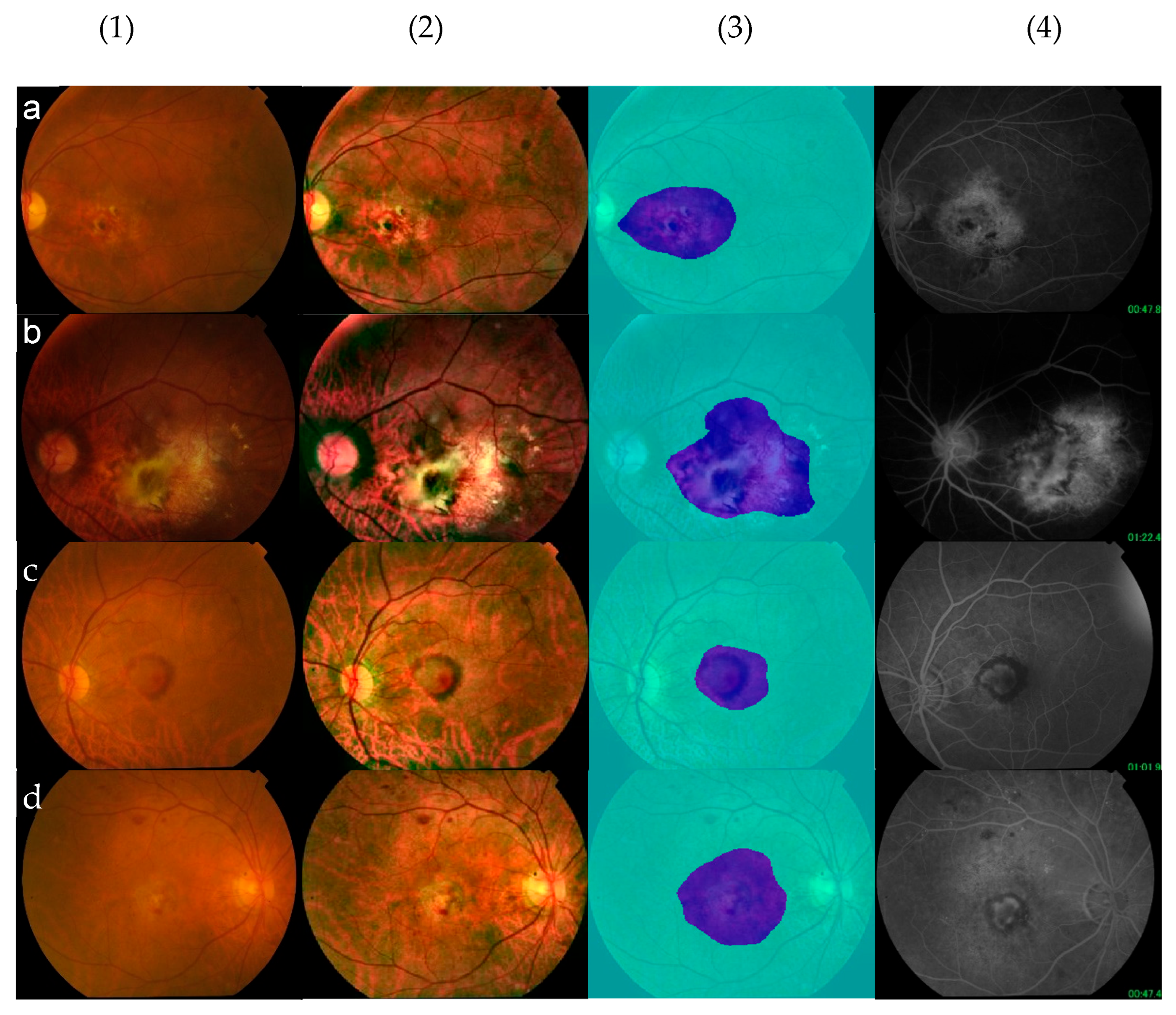 Brainsci 15 01249 g003