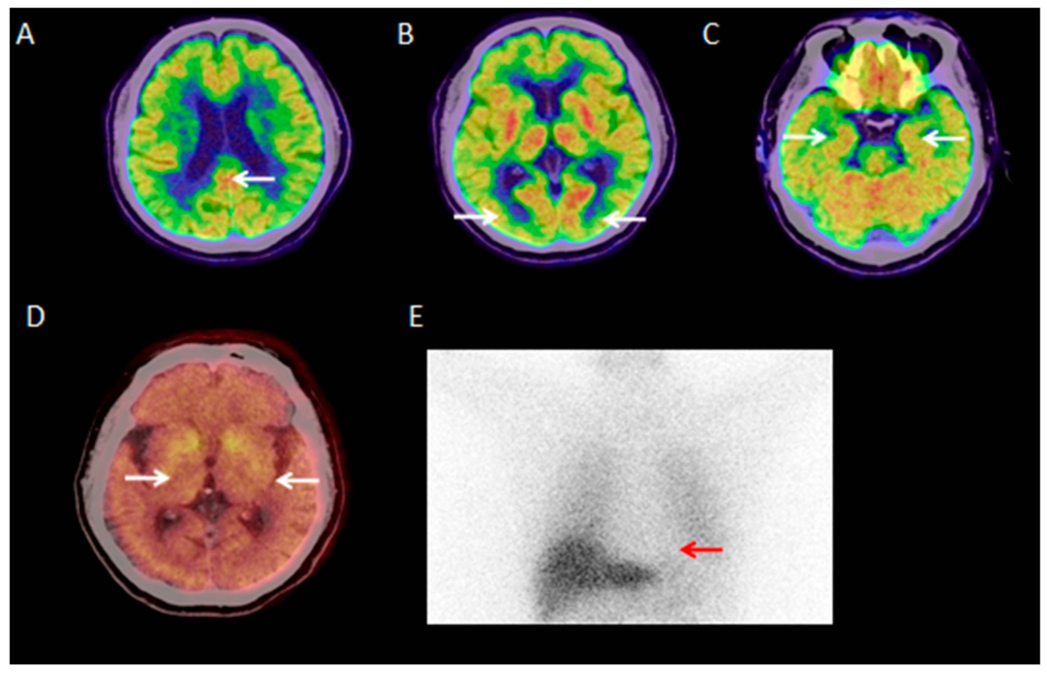Brainsci 15 01264 g001