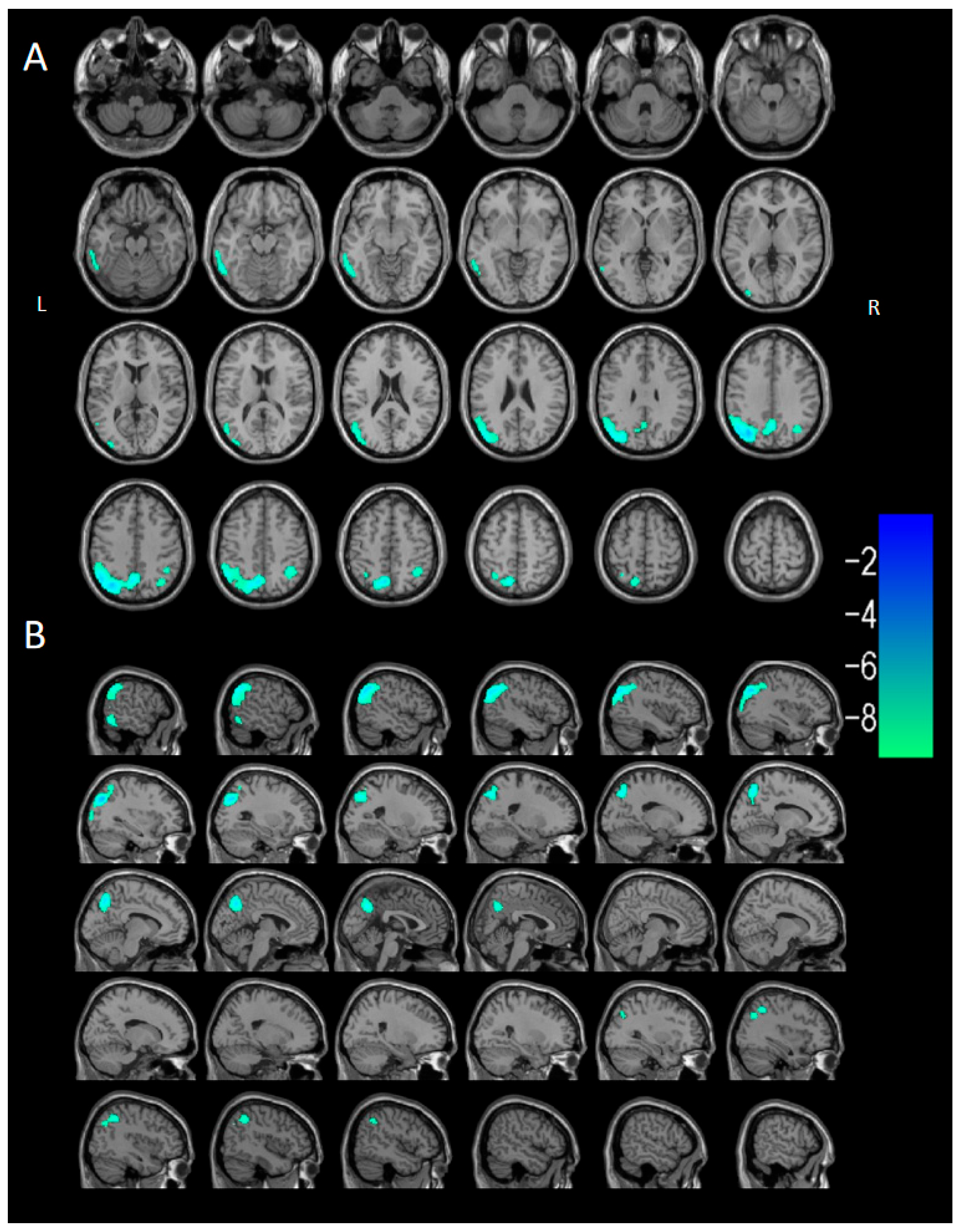 Brainsci 15 01264 g004