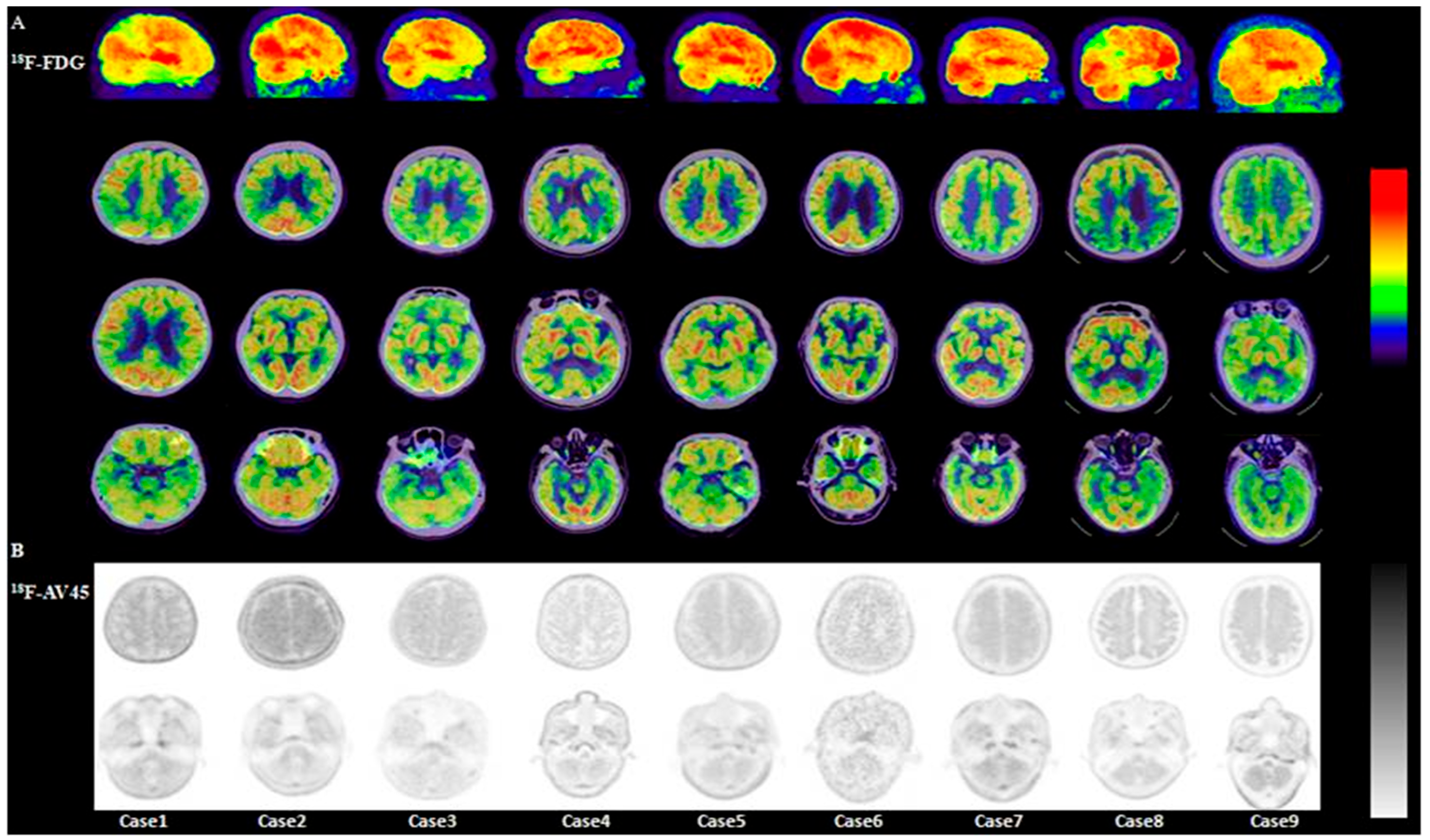 Brainsci 15 01264 g005