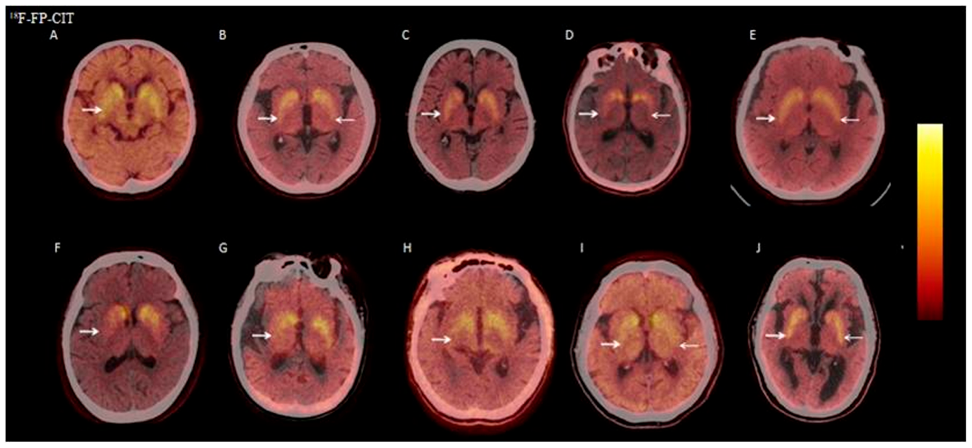 Brainsci 15 01264 g006