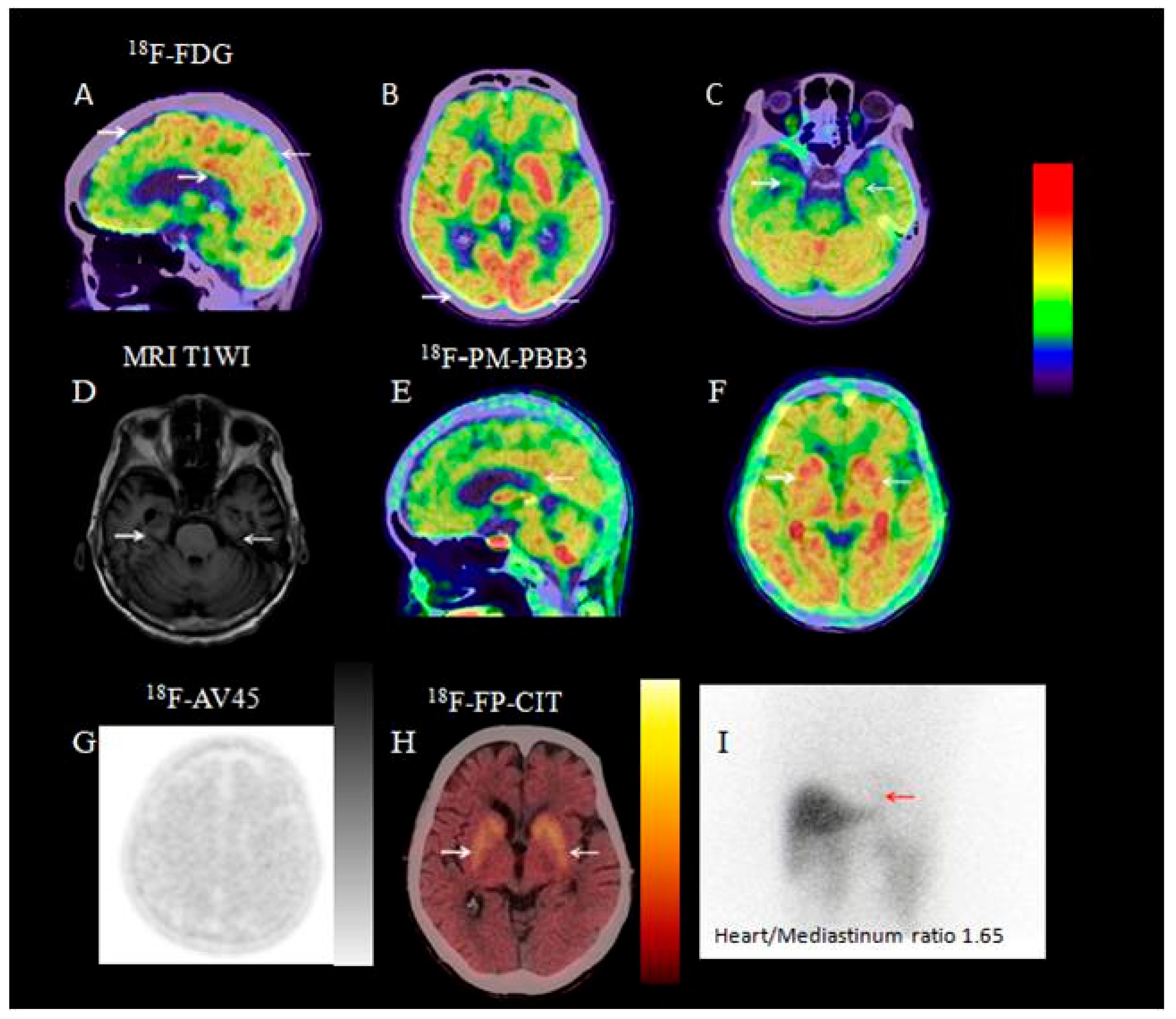 Brainsci 15 01264 g008