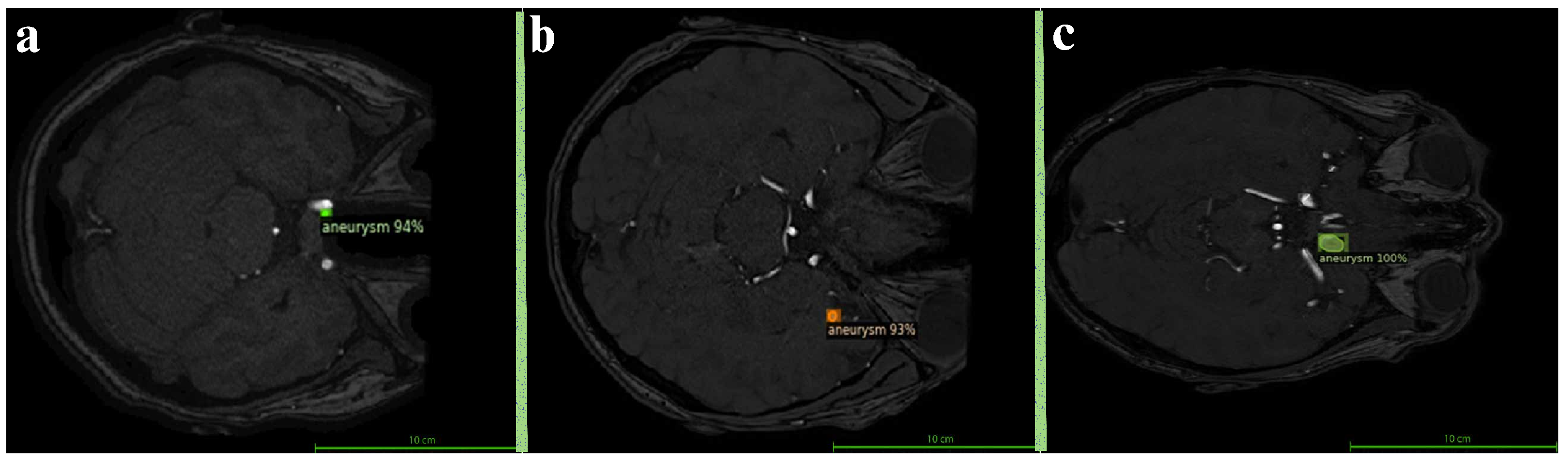 Brainsci 15 01295 g006