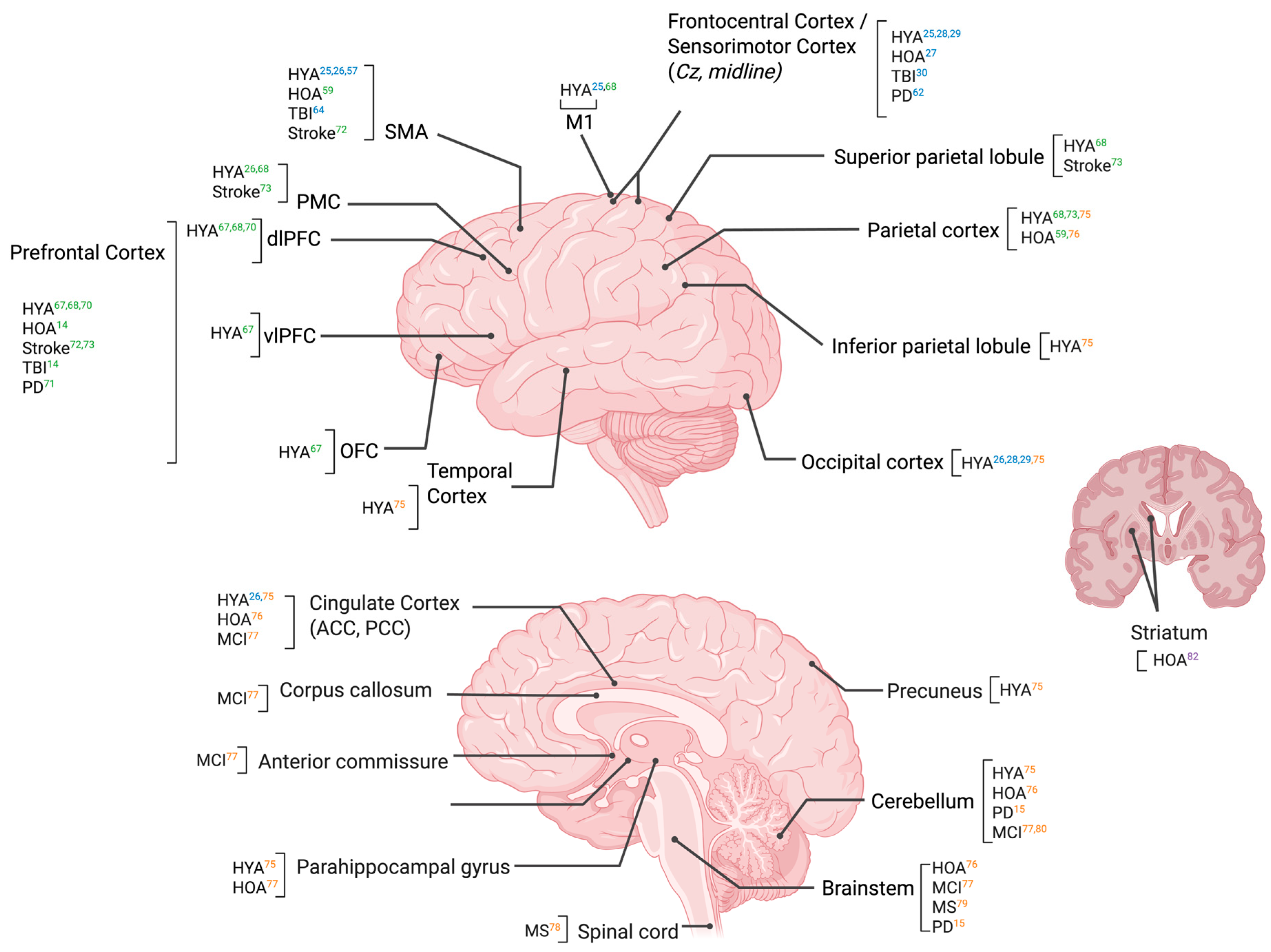Brainsci 15 01330 g002 Brainsci 15 01330 g002