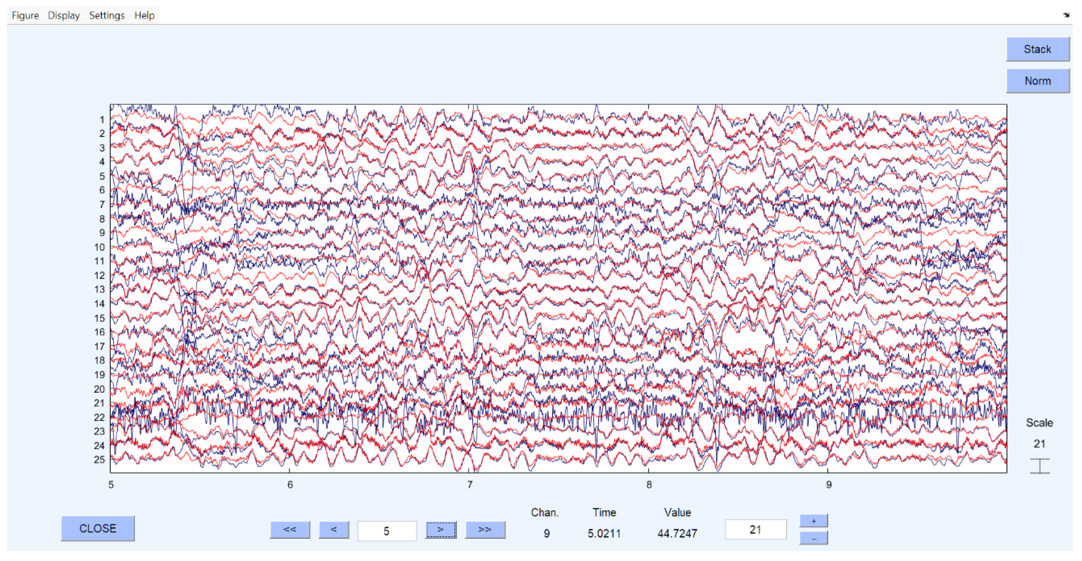 Brainsci 15 01334 g001