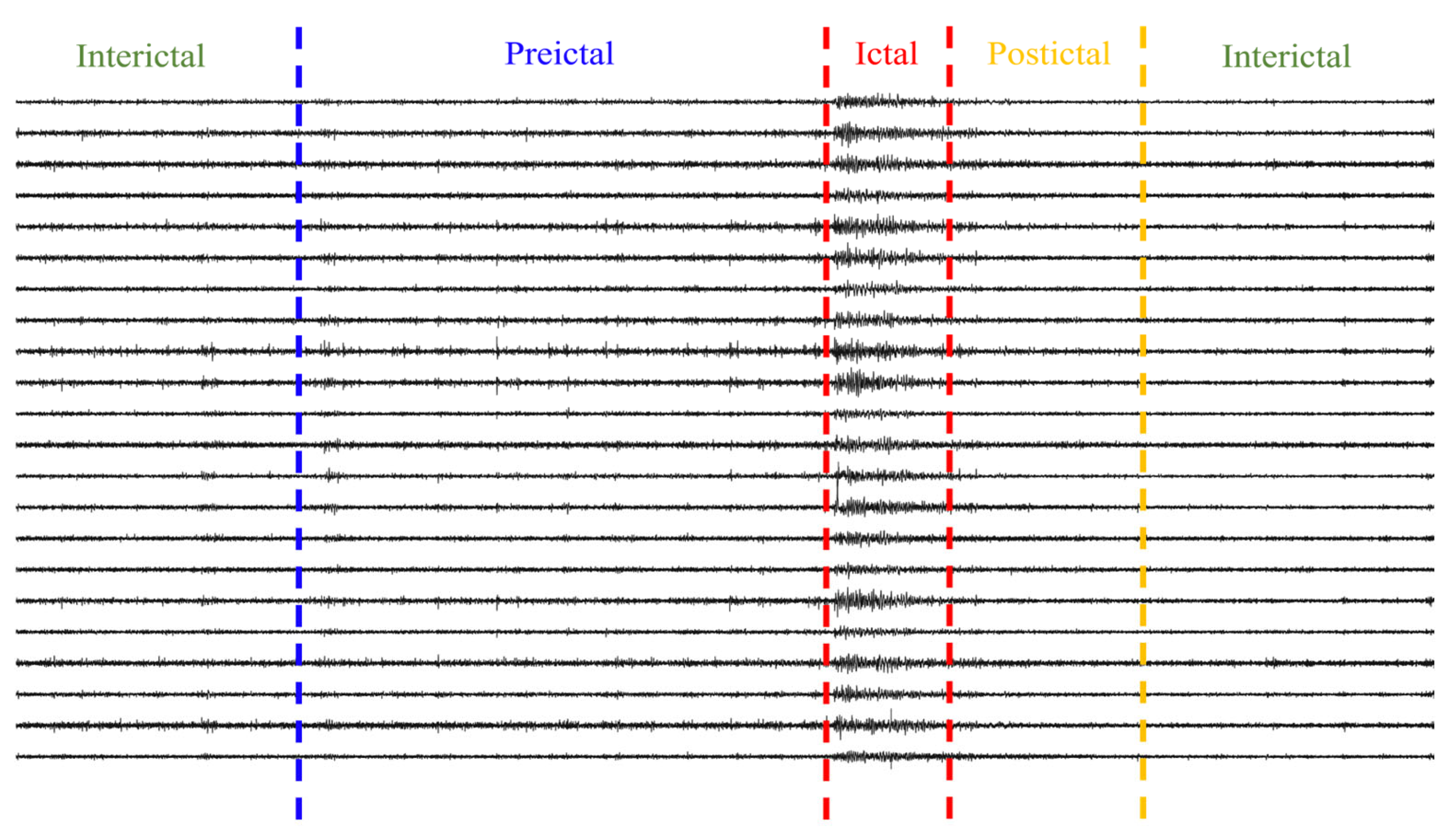 Brainsci 16 00083 g002
