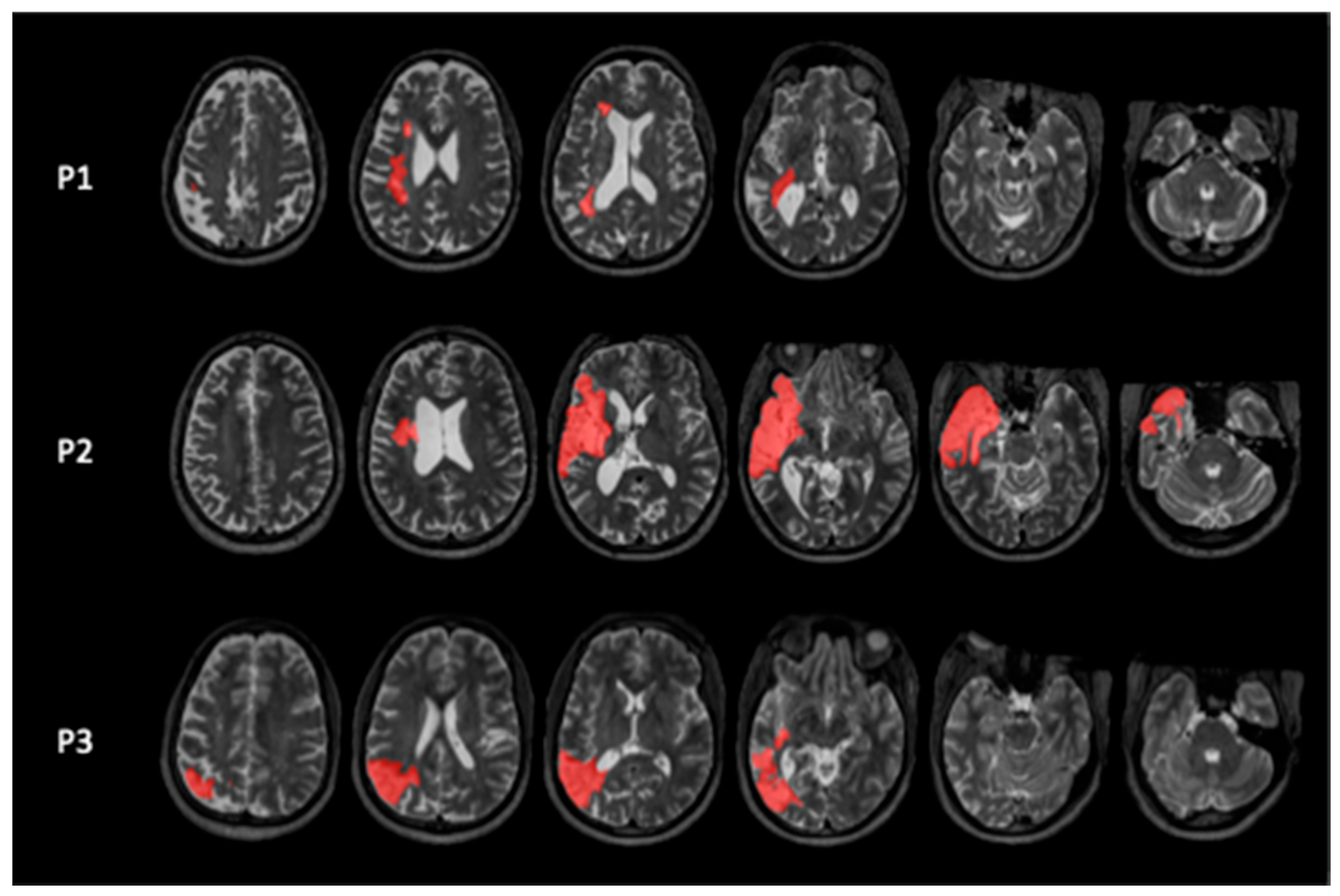 Brainsci 16 00117 g001