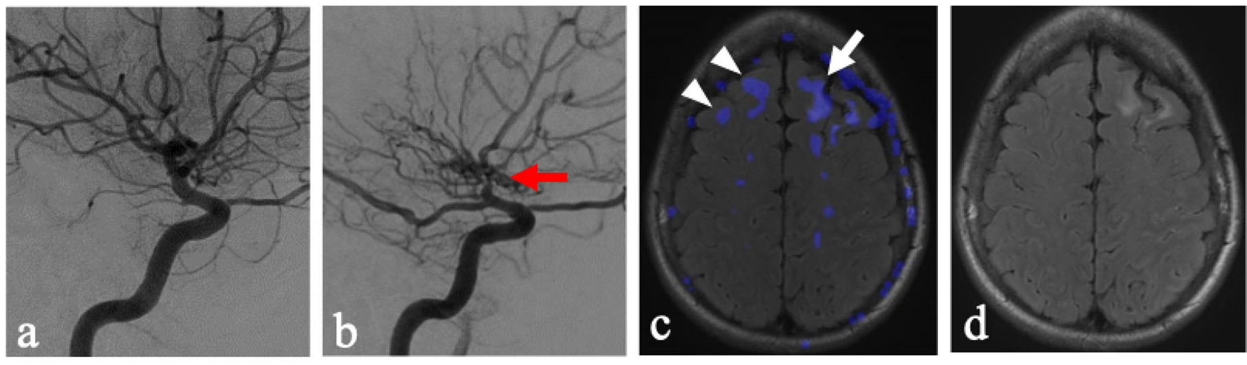 Brainsci 16 00160 g002