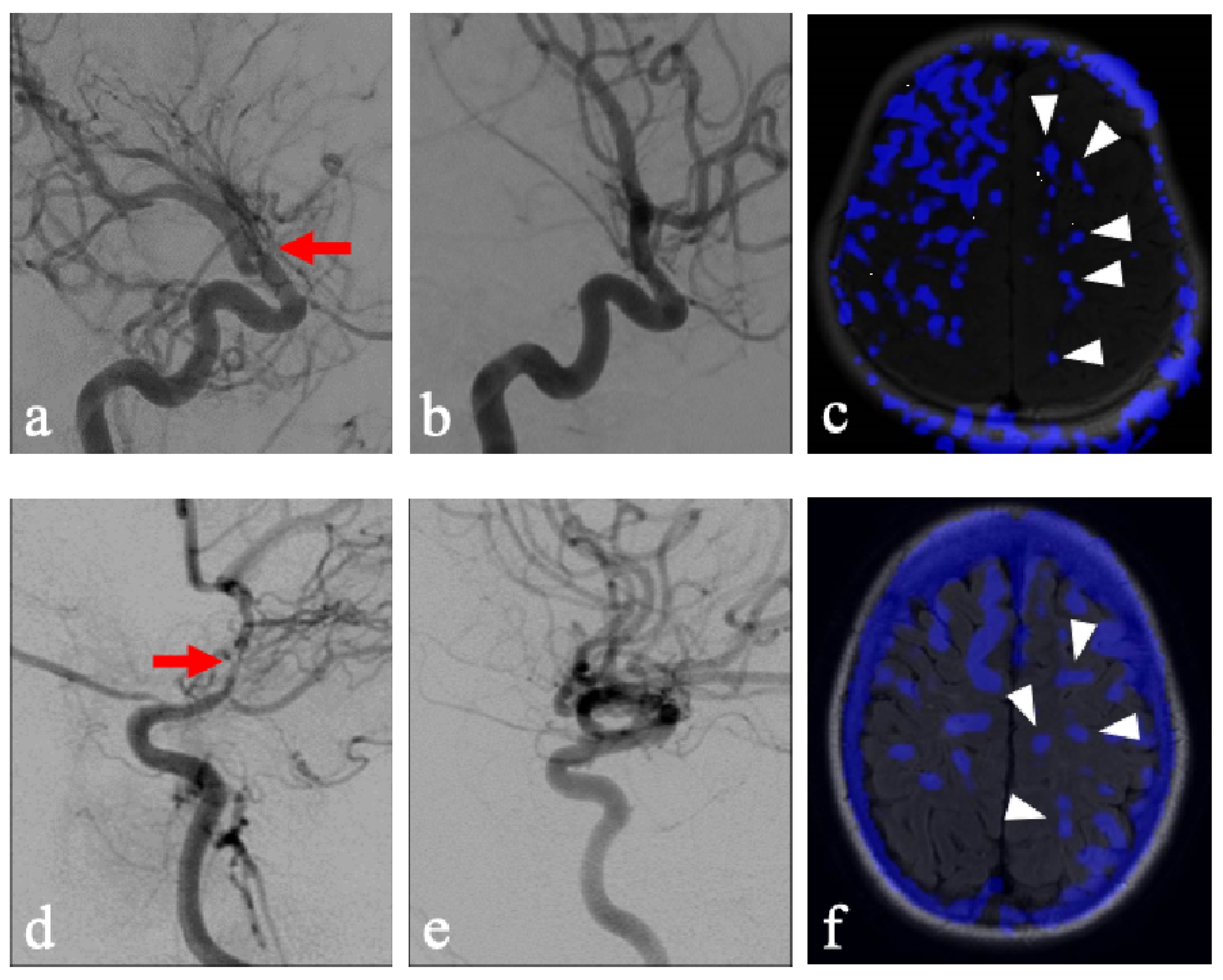 Brainsci 16 00160 g003