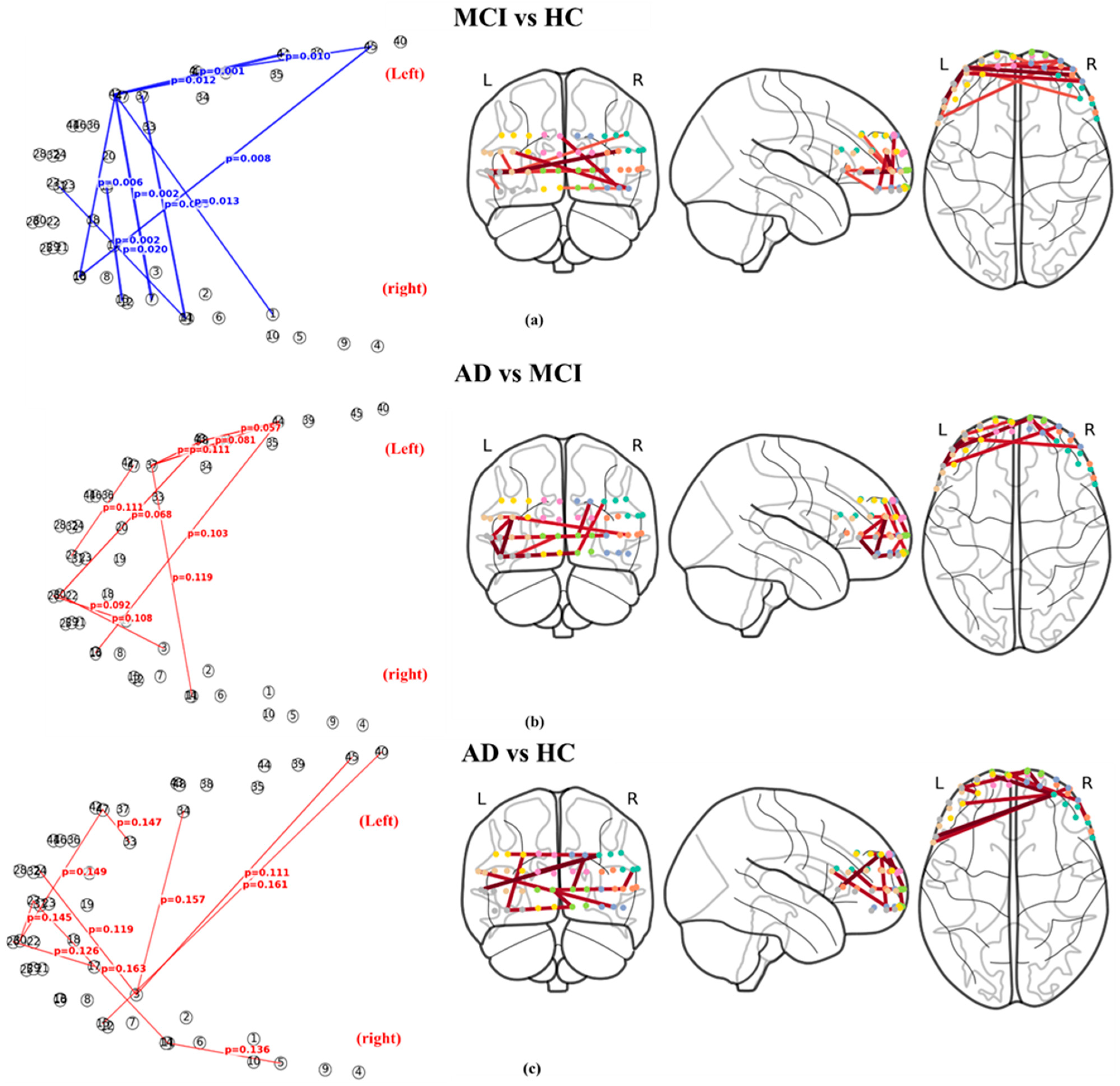 Brainsci 16 00239 g006