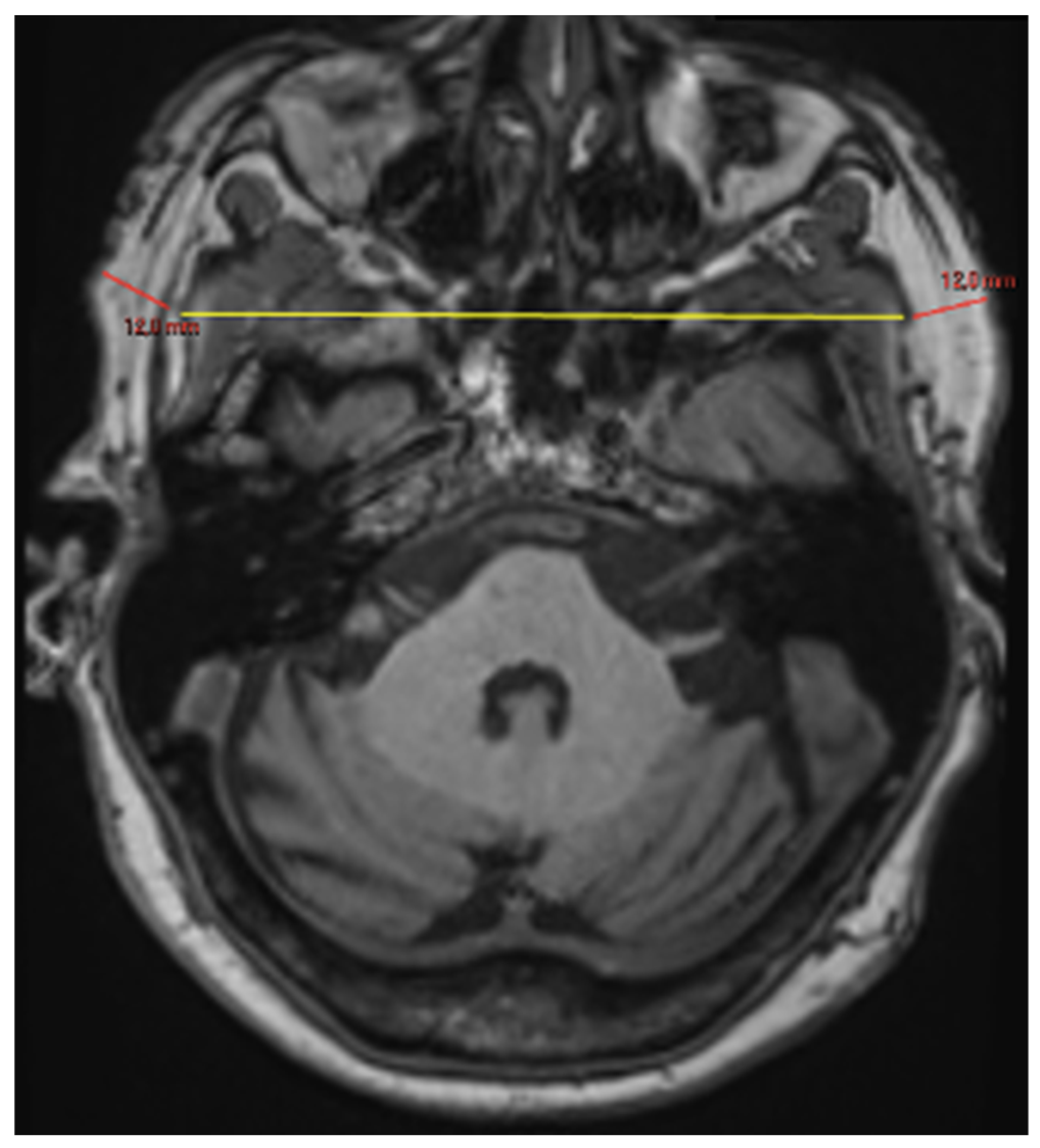 Brainsci 16 00403 g002 Brainsci 16 00403 g002